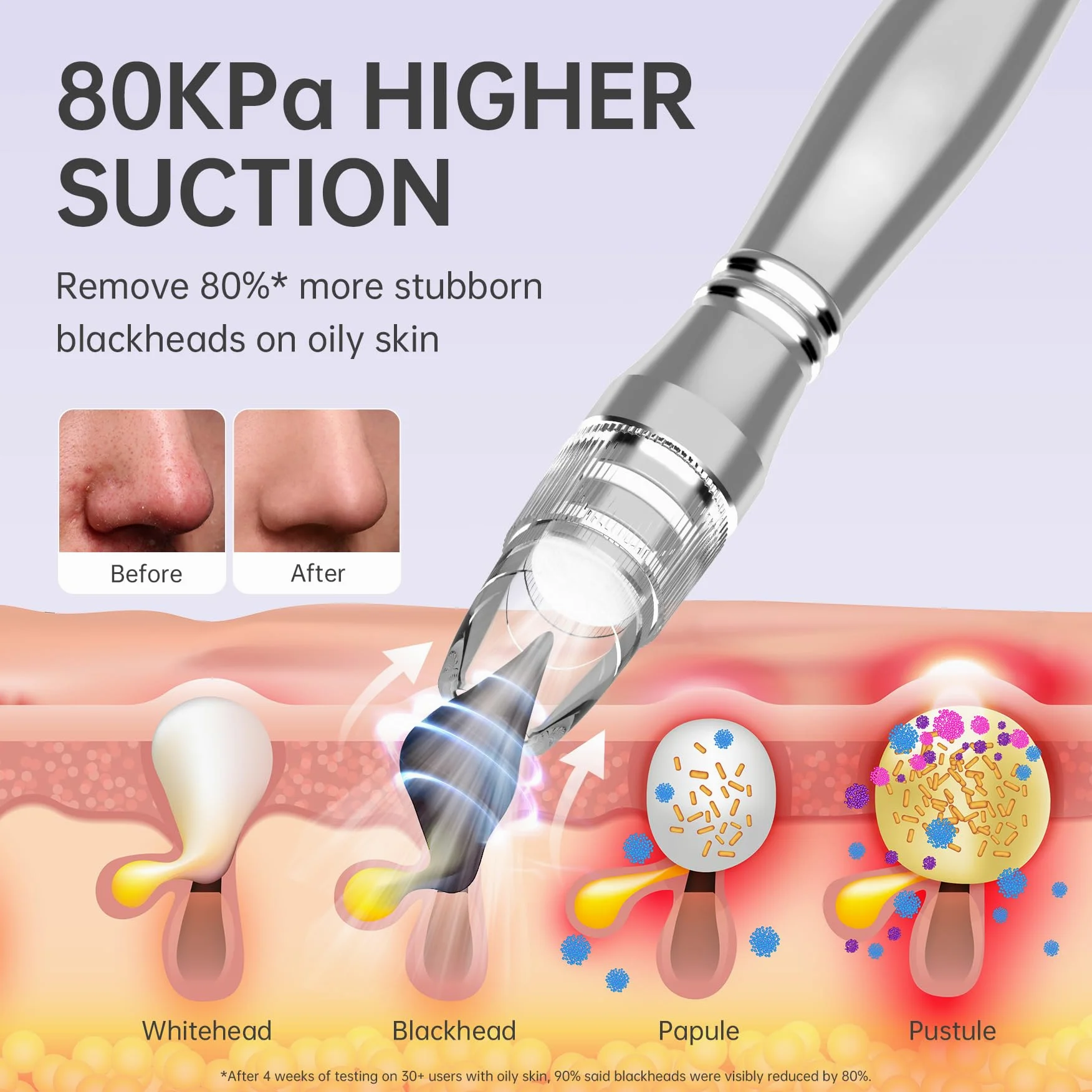 UNOISETION Removedores de puntos negros, 2 en 1 de grado profesional para spa en casa, limpiador facial de poros para puntos negros, puntos blancos, exfoliación, succión ajustable de 20-80 Kpa para