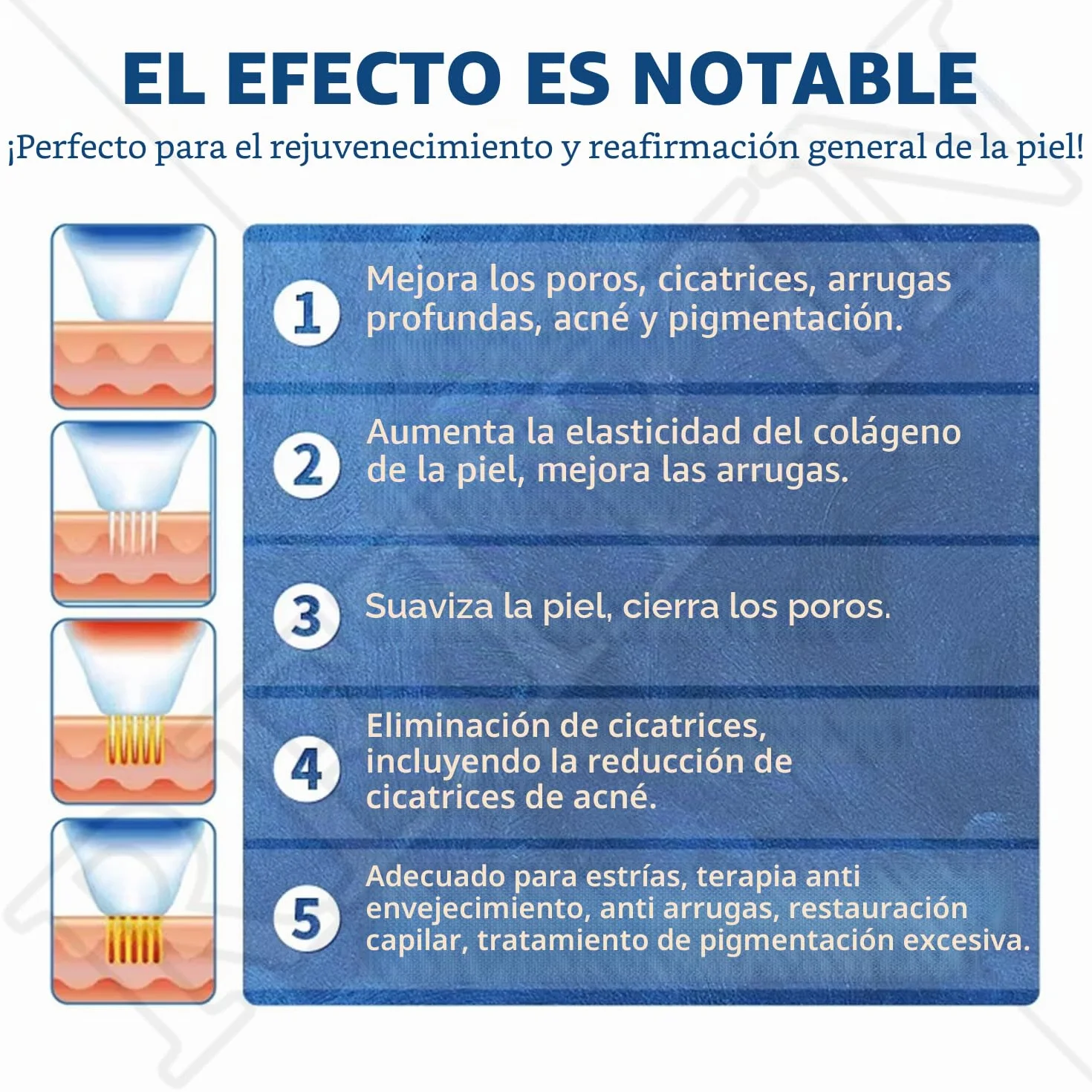Dispositivo Avanzado de Belleza con 4 Cabezales Especializados: Combina Microagujas y RF para Tratamientos Faciales y Corporales de Rejuvenecimiento y Reparación Cutánea