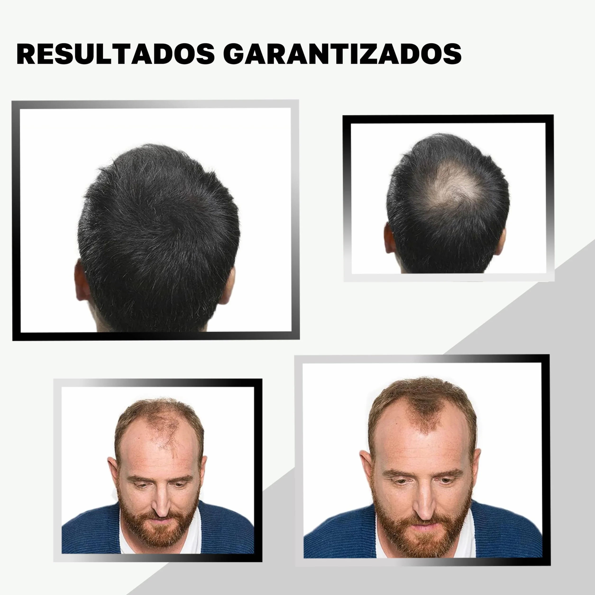 VidalForce Fibra Capilar Negro 5g Polvos Voluminizador Pelo Hair Building Fibers