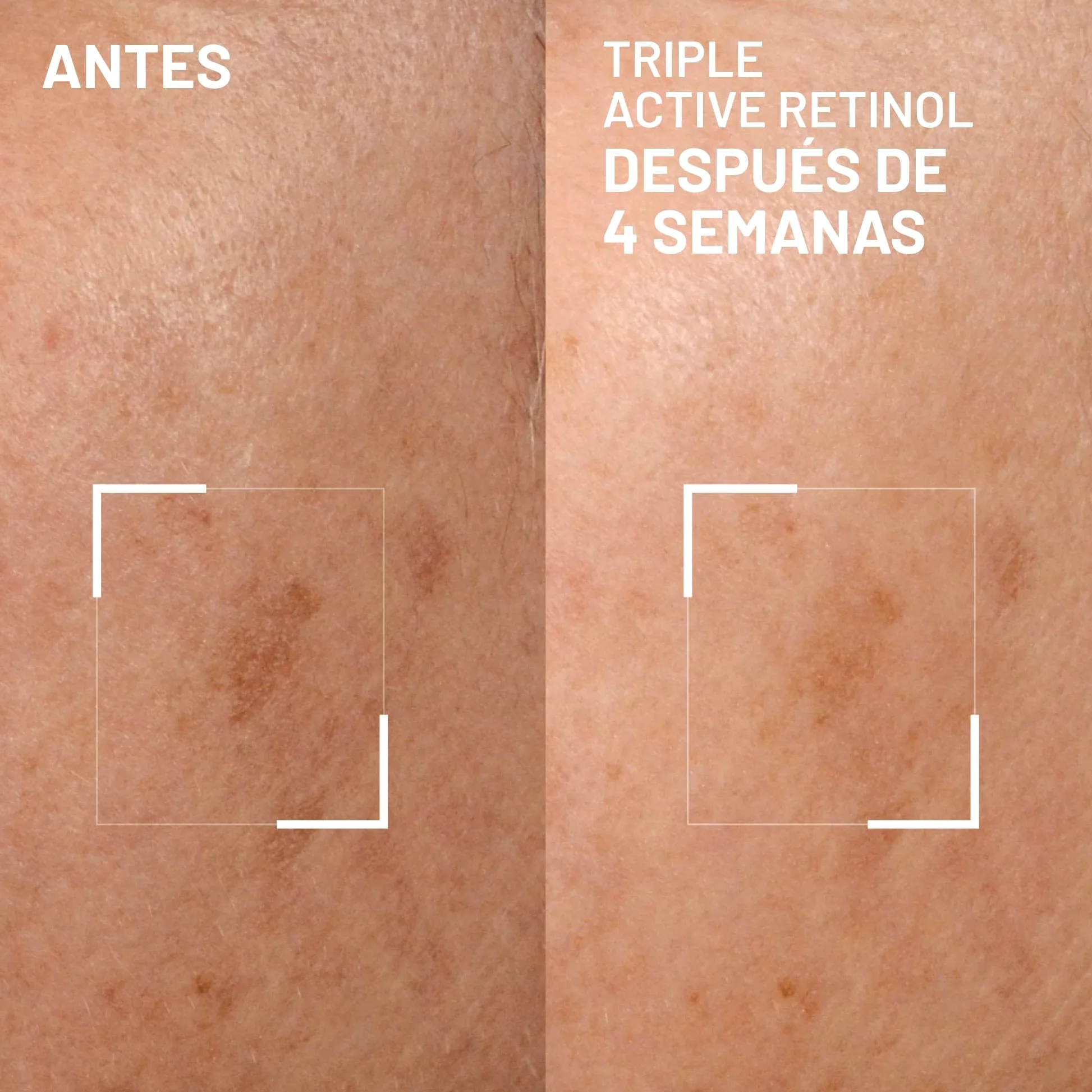 Bright This Way Triple Active Retinol del Dr. Brandt - Crema Renovadora Suave Para la Noche - Reduce Las Arrugas y La Decoloración, Ilumina e Hidrata - 30 ml