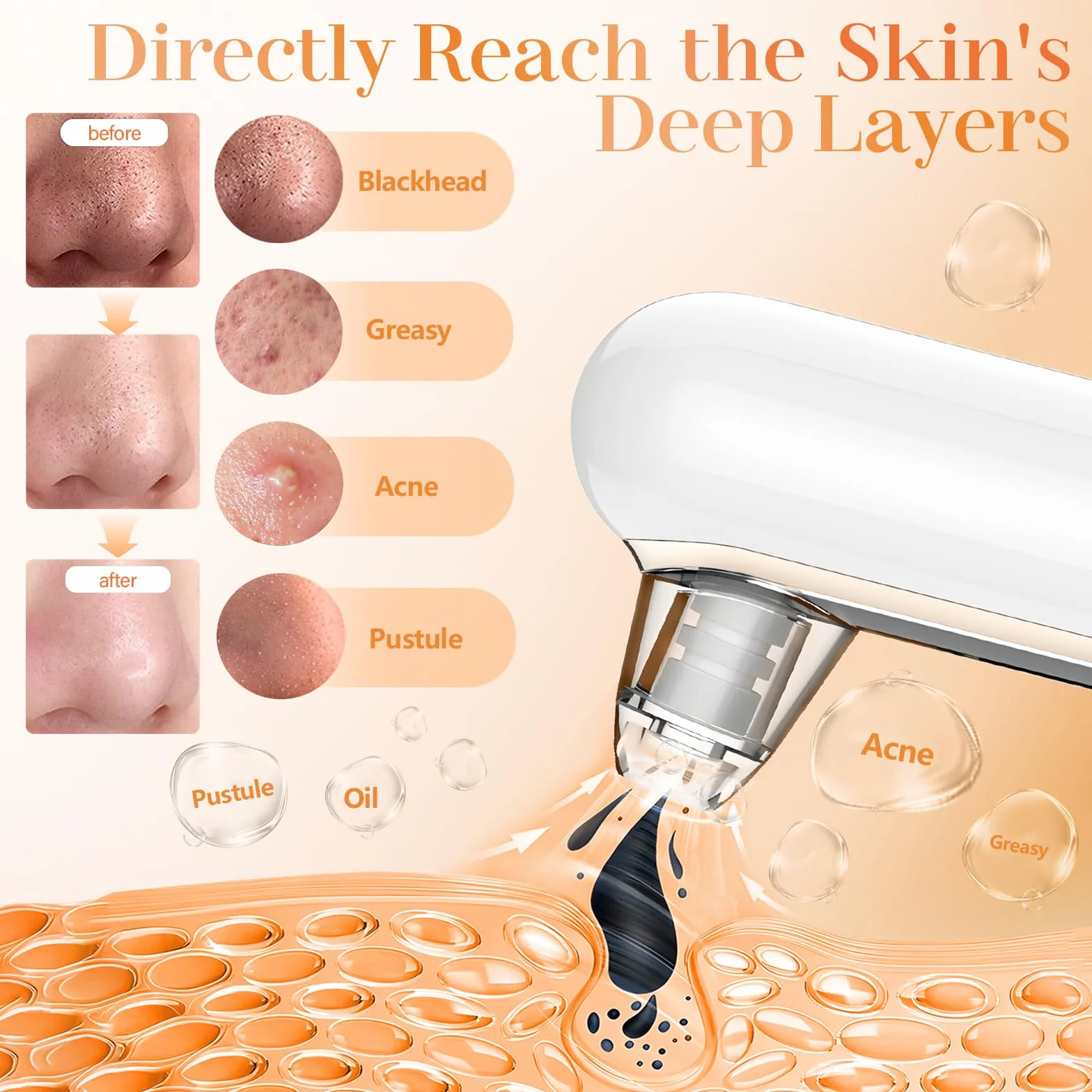 Yccu Succionador de Puntos Negros, Limpiador de Poros Eléctrico, 4 Modos