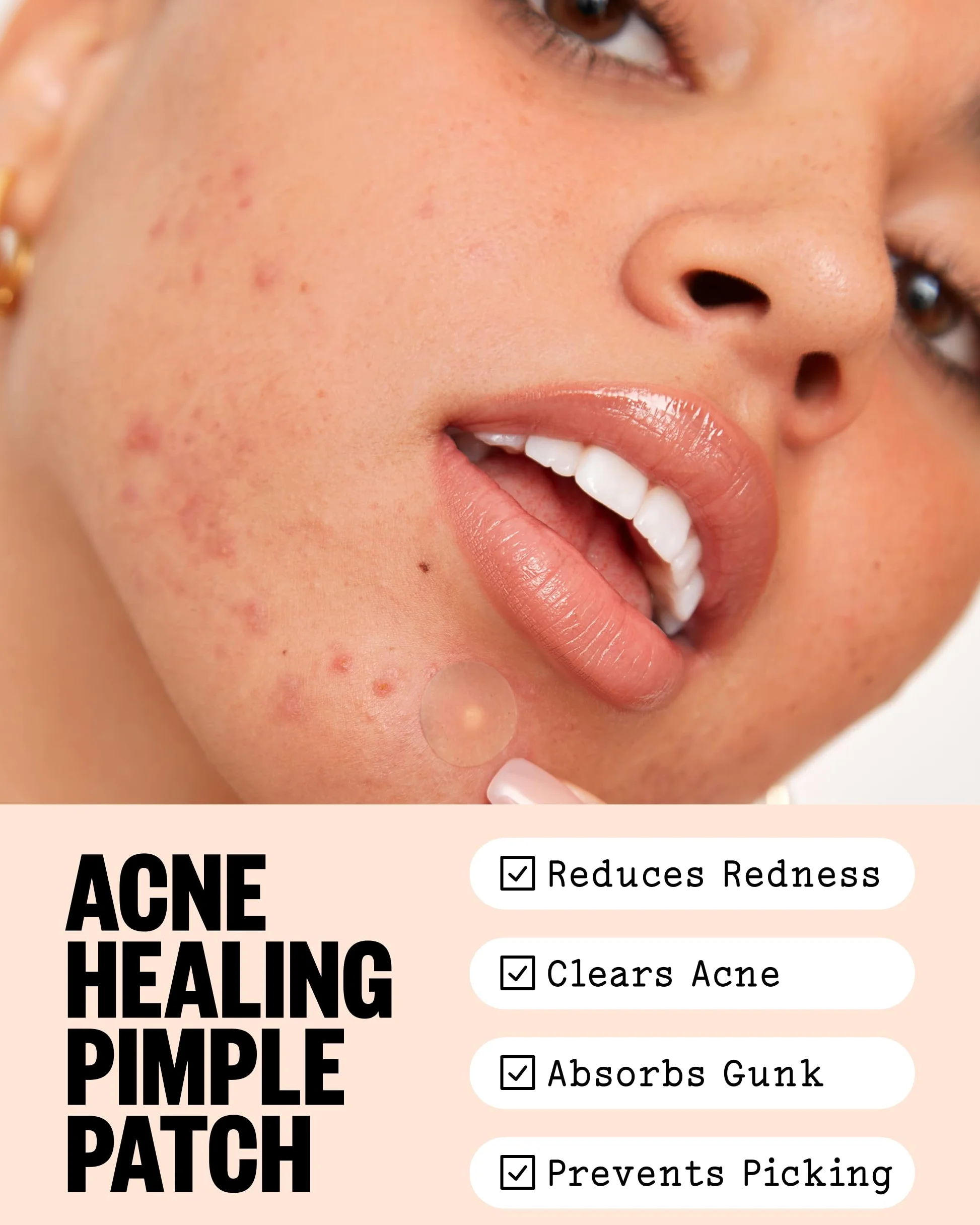 PEACE OUT Parches hidrocoloides para curar el acné, tratamiento de manchas de acné con ácido salicílico, retinol y aloe vera para imperfecciones y brotes (40 unidades)