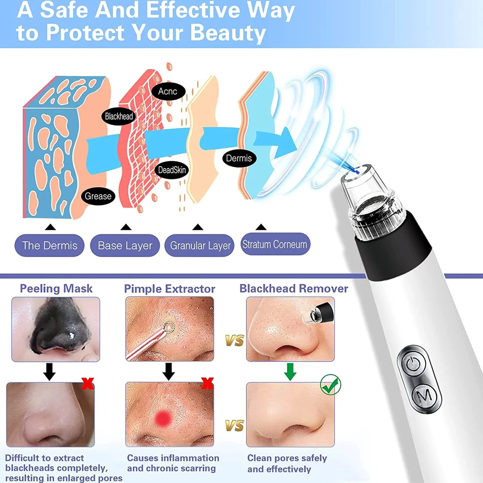 Limpiador facial de poros, limpiador eléctrico de poros, herramienta de succión de puntos negros, herramienta de extracción de puntos blancos, extractor de espinillas de limpieza facial, removedor de