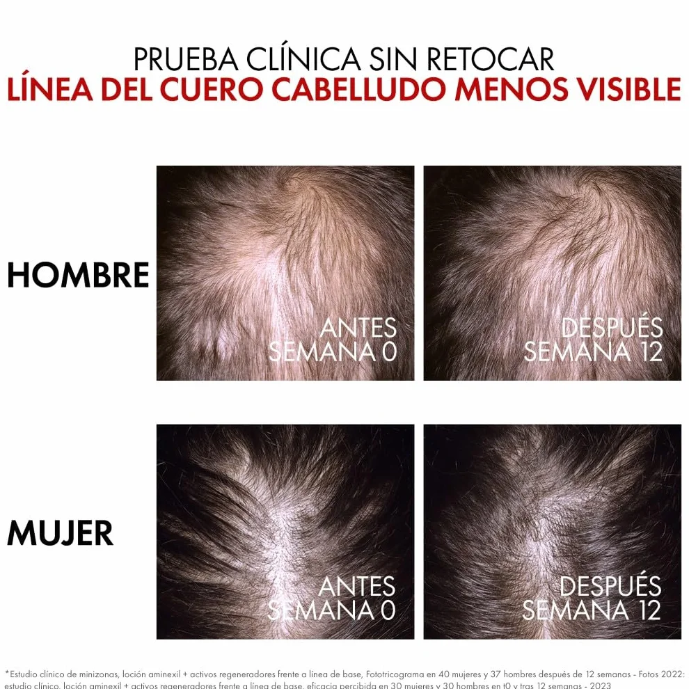 Vichy Dercos Aminexil Clinical R.E.G.E.N. Booster Sérum Regenerador Capilar Reduce Caída Crecimiento Cabello