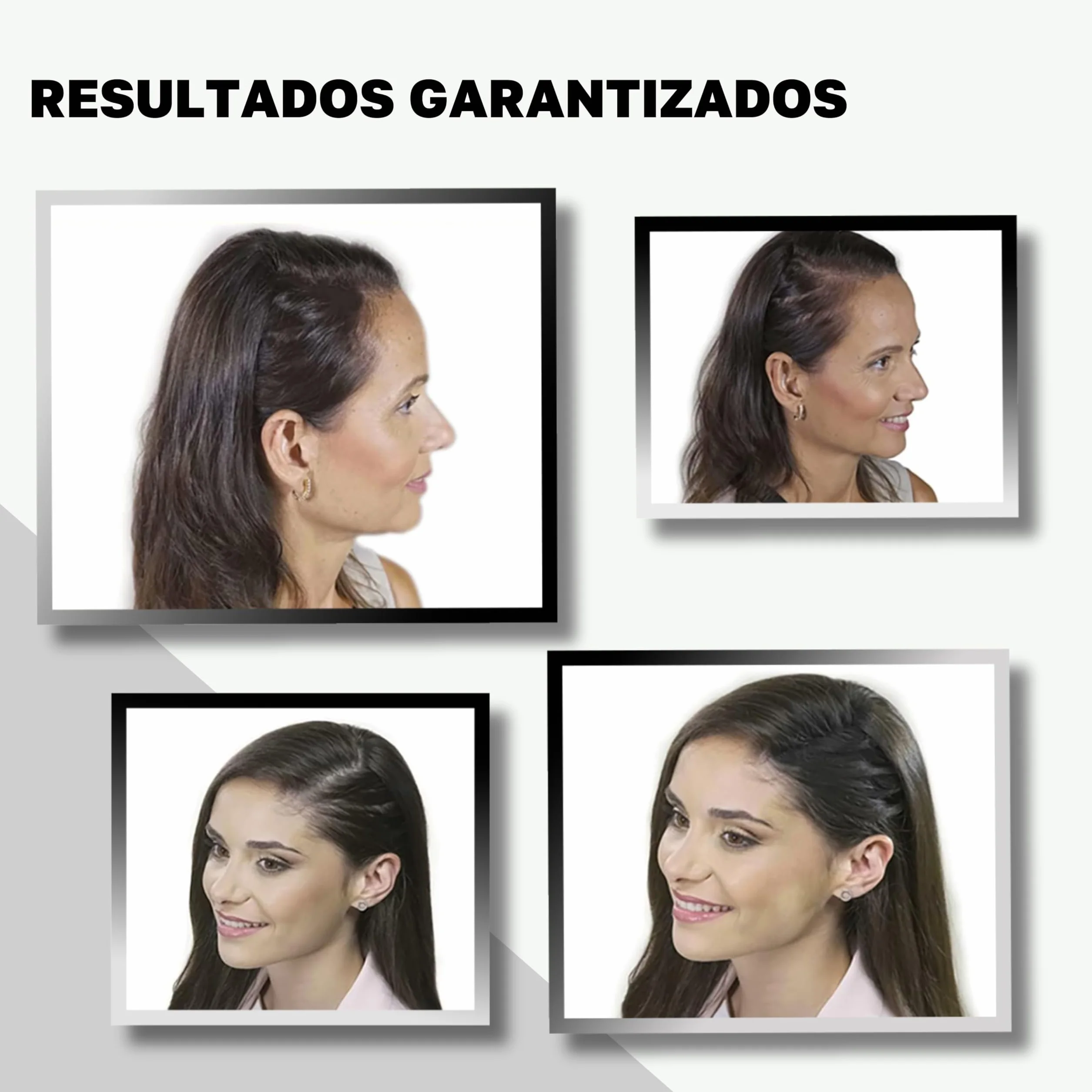 VidalForce Fibra Capilar Negro 5g Polvos Voluminizador Pelo Hair Building Fibers