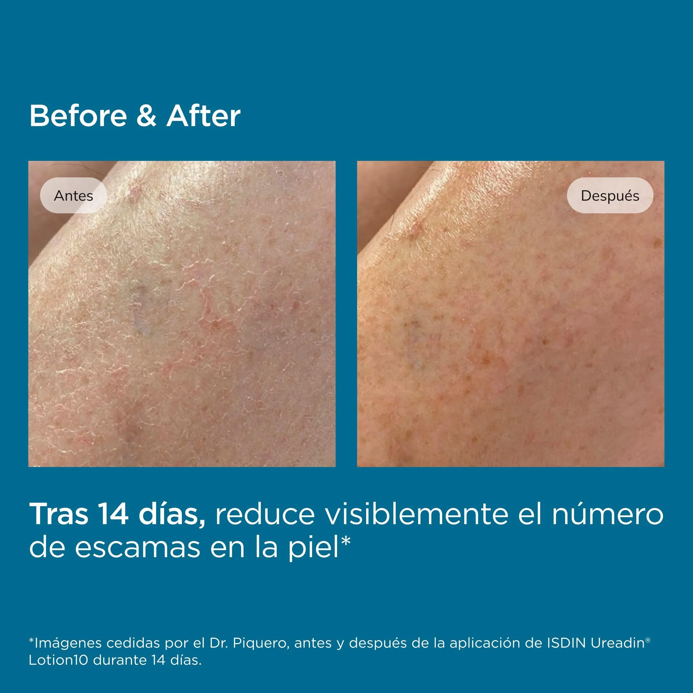 ISDIN Ureadin Lotion 10 Loción Hidratante 10% Urea 750 ml