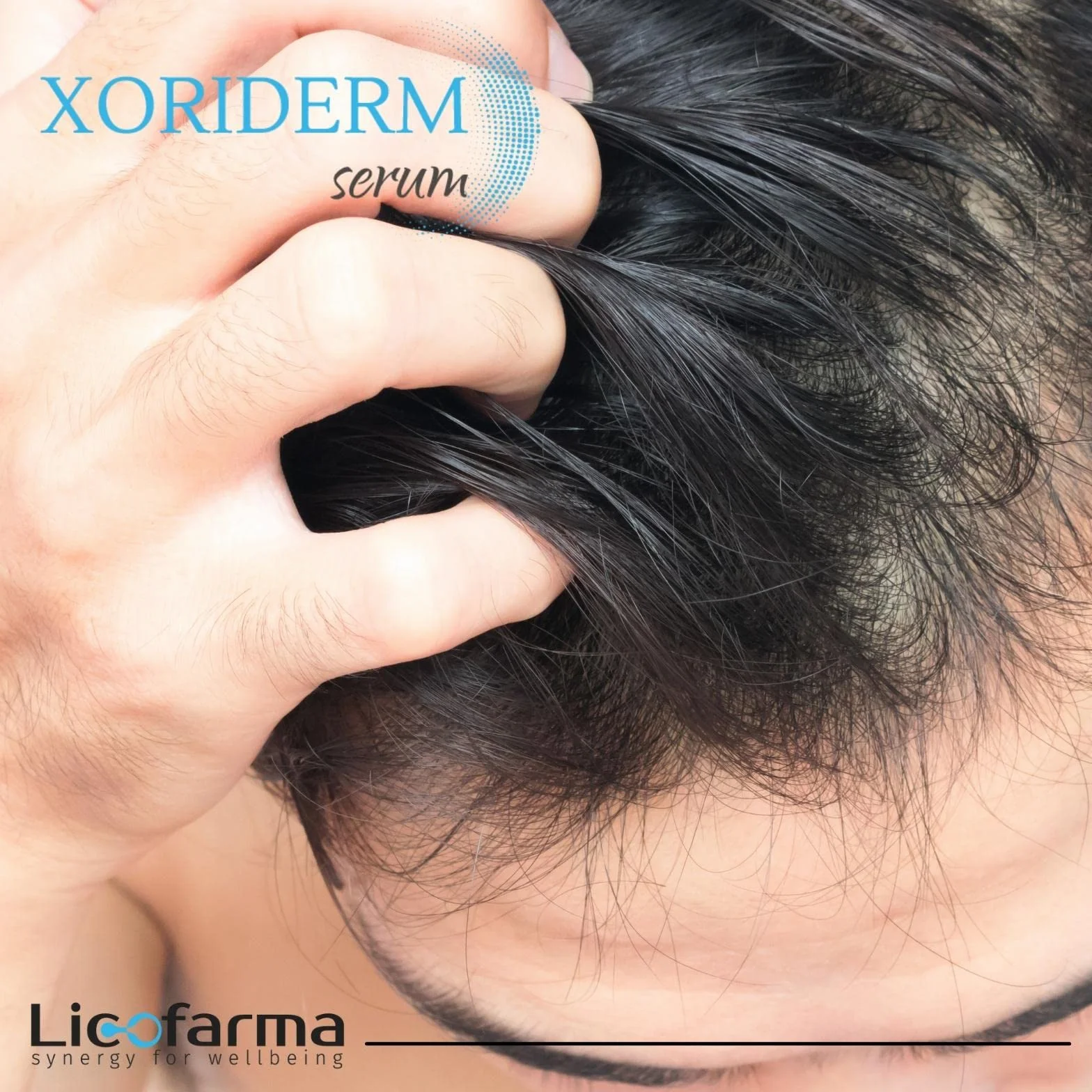 Xoriderm Serum Loción en Espray contra Psoriasis y Dermatitis del Cuero Cabelludo