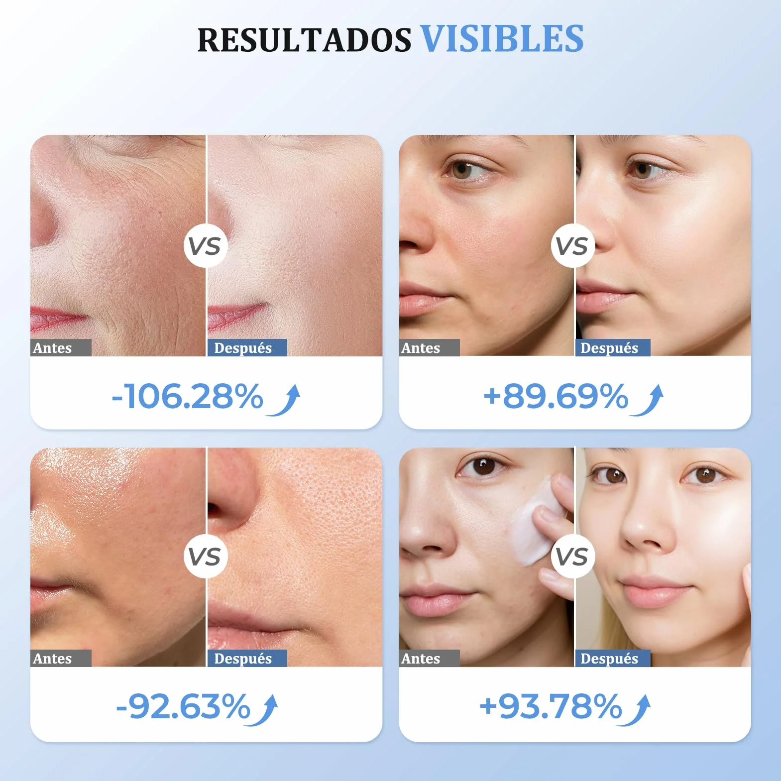 Aparato Radiofrecuencia Facial, 5 en 1 Masajeador Facial de Microcorriente, Dispositivo Eléctrico de Belleza Antiarrugas, Antiacné, Reafirmante y Lifting para Rostro y Cuello