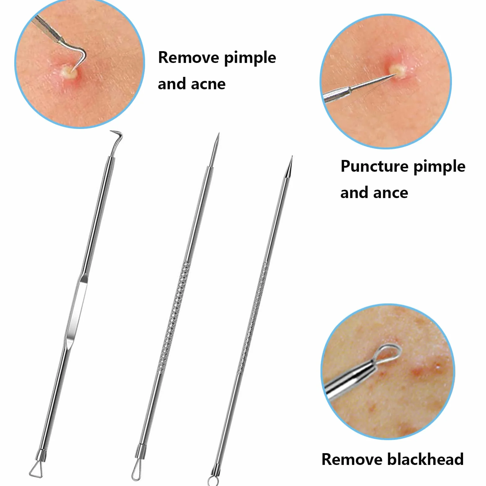 Extractor de acné 5 Piezas Kit para eliminar espinillas y puntos negros