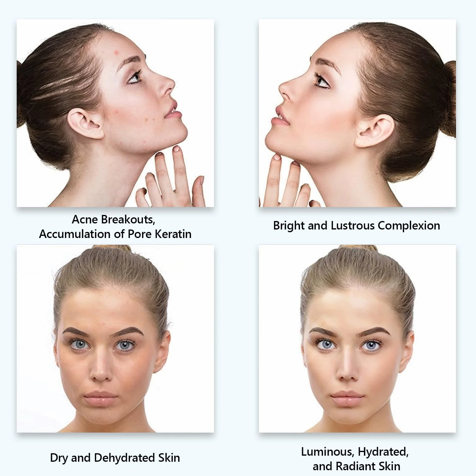 Microneedling Inalámbrica Profesional Ultima A1, Máquina Eléctrica de Microneedle con 22 Cartuchos de Repuesto, Derma Pen Kit de Cuidado de la Piel para el Tratamiento Antienvejecimiento Anti-Acné