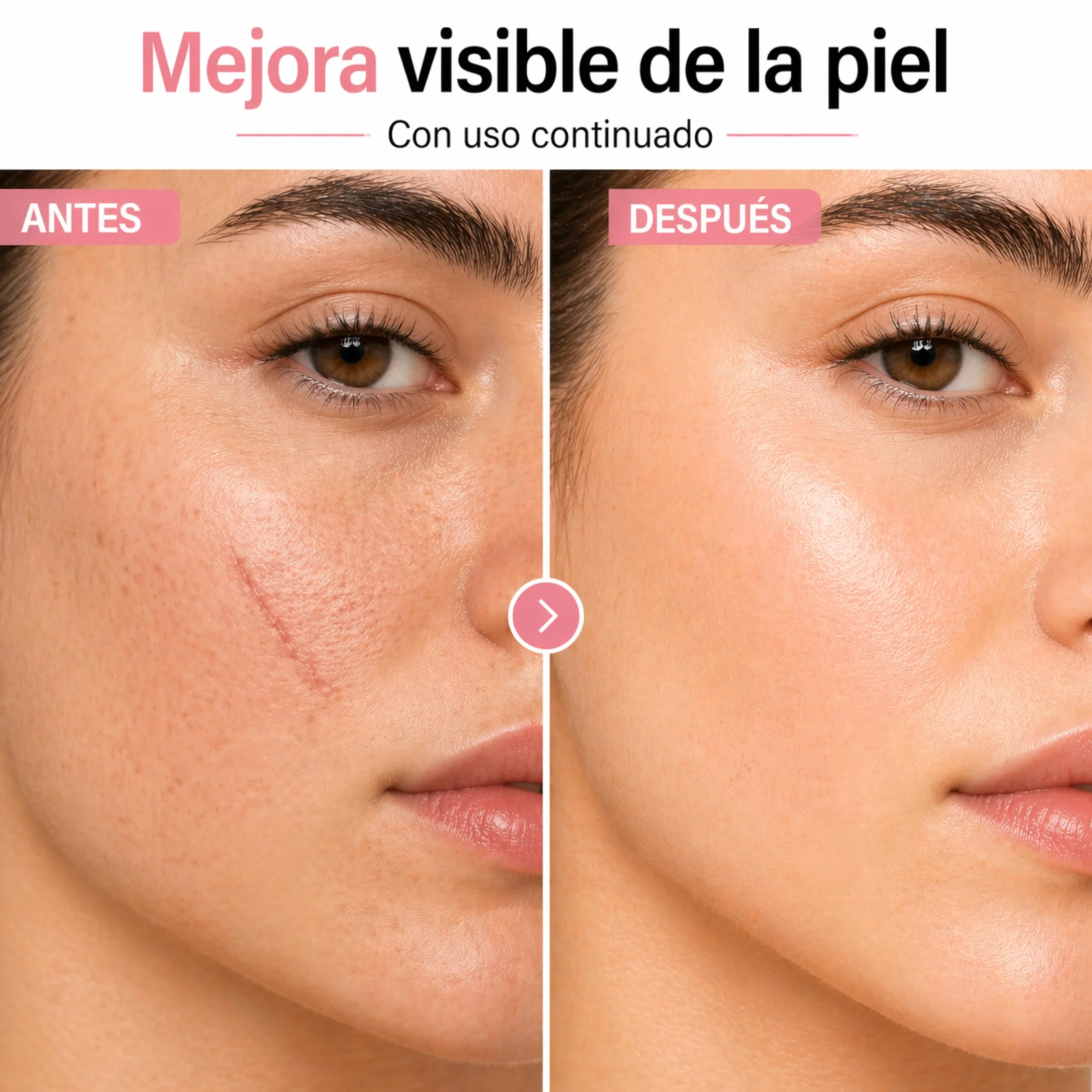 Aceite Rosa Mosqueta 100% Puro para Cicatrices - Essenciales 10 ml