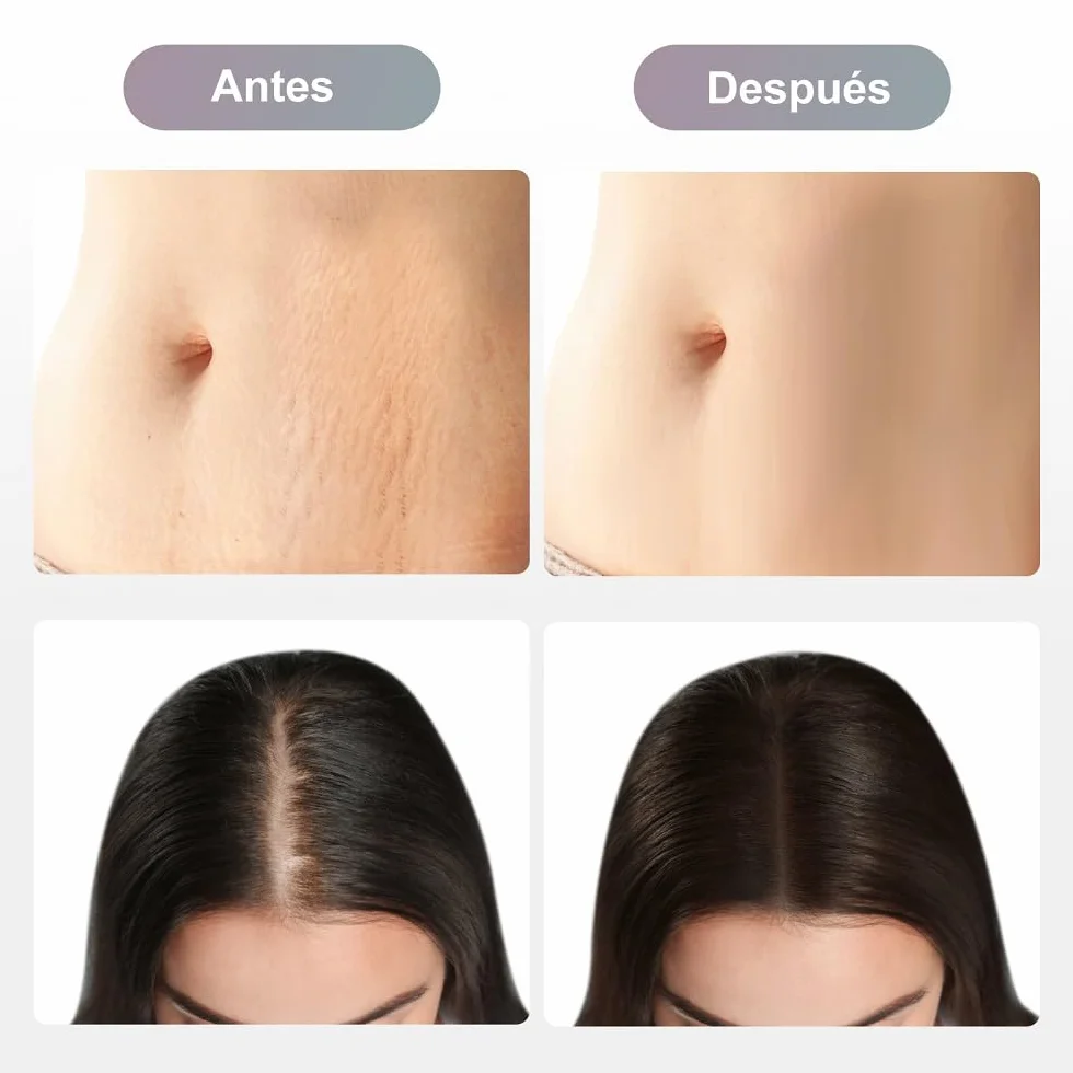 Dr.pen Cartuchos 36 Pins 20Pcs Originales Agujas Compatible Ultima M8 M7S Dermapen Profesional