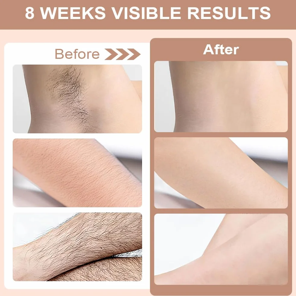 Depiladora Laser IPL 999990 Flashes 5 Niveles Energía para Mujer