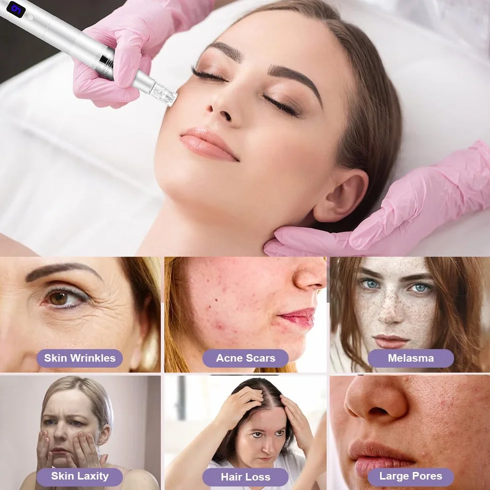 Vicloon Microneedling Pen Inalámbrico Profesional, 12 Agujas, 6 Velocidades, 0-2.5mm Ajustable, Máquina Eléctrica para Cuidado Facial