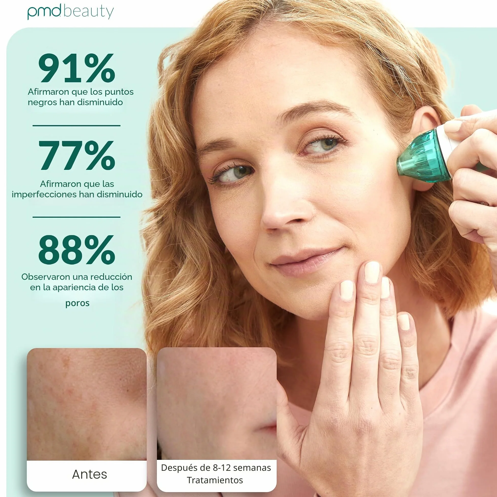 PMD Personal Microderm Classic - Máquina de microdermoabrasión en casa con kit para cara y cuerpo - Cristales exfoliantes y succión al vacío para piel fresca y radiante