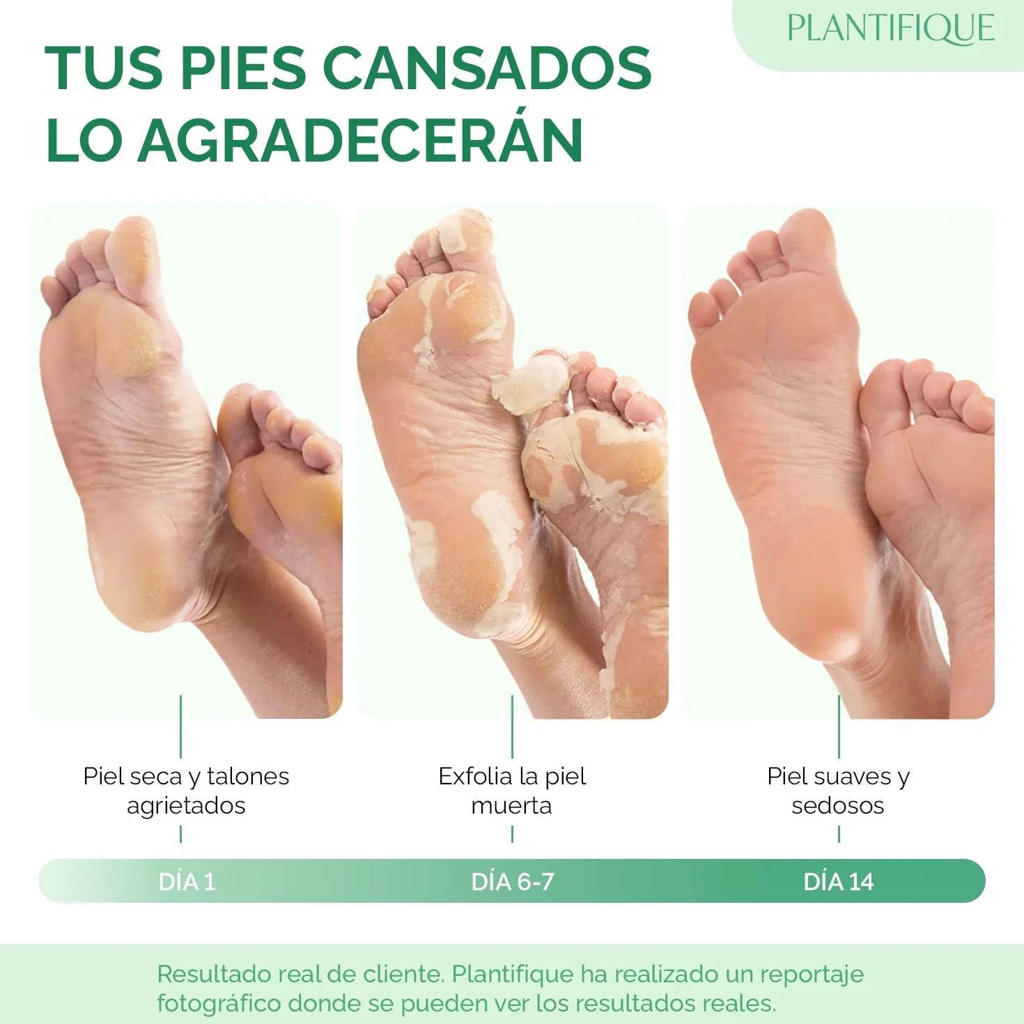 PLANTIFIQUE Calcetines Exfoliantes de Pies 4 Combo Pack Mascarillas Peeling Callos Eliminar Pedicura Profesional