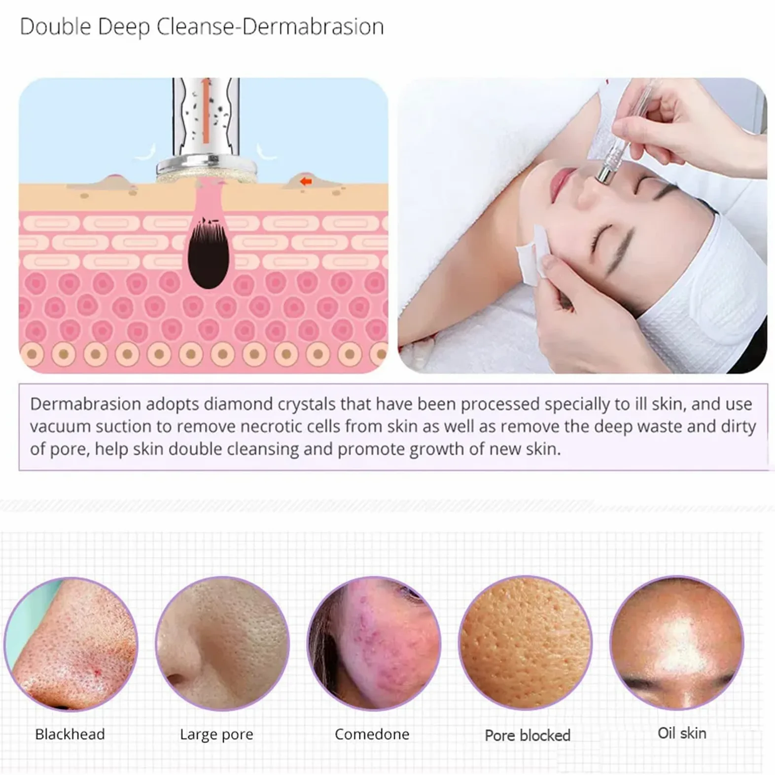 Máquina facial galvánica profesional 5 en 1: dispositivo de belleza de microdermoabrasión e iontoforesis para limpieza profunda, infusión de suero y estiramiento de la piel, sistema de spa facial en