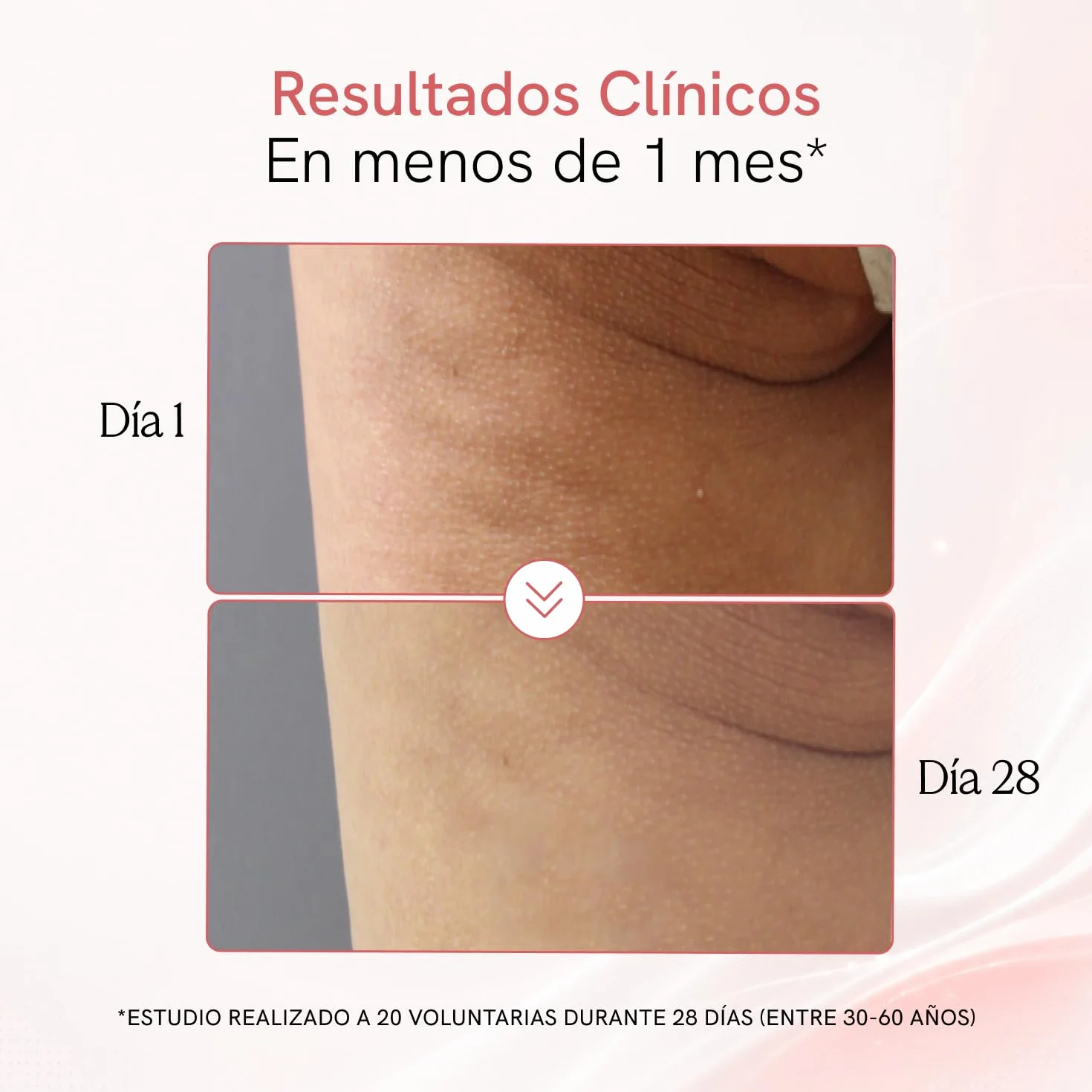 Crema Anticelulítica Reductora 500 ml, Reafirmante Corporal, Gel Reductor Abdomen y Glúteos, Radiofrecuencia Corporal, Tratamiento Anticelulitis Profesional