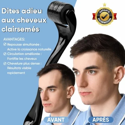 Dermaroller 0.5 mm para Crecimiento del Cabello y Barba – Microneedling Estimulante Folículo Capilar Uso Facial Hombre Mujer