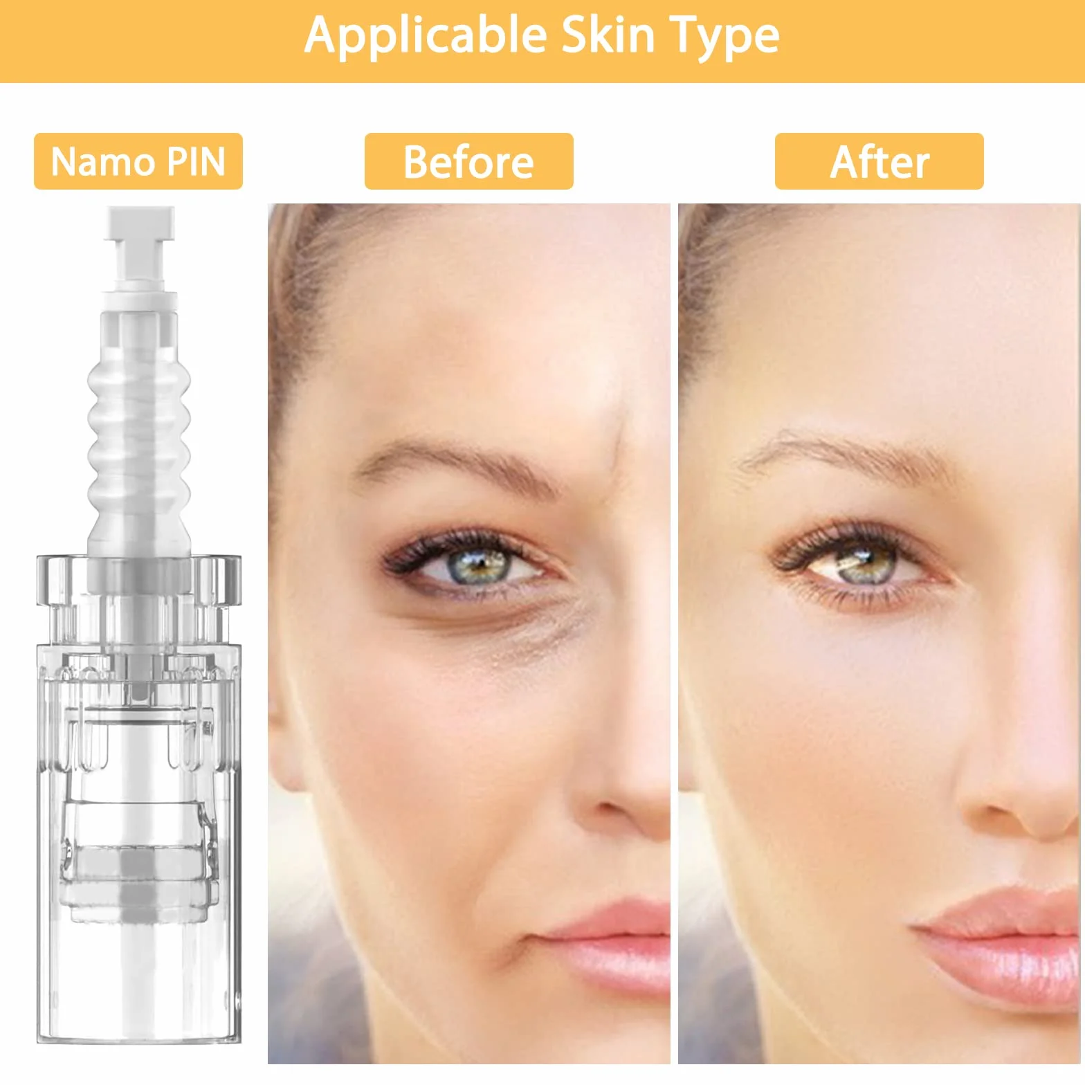 Agujas Dermapen Microneedling Nanoagujas Redondos 20 Pcs Cartucho de Substituição Baioneta