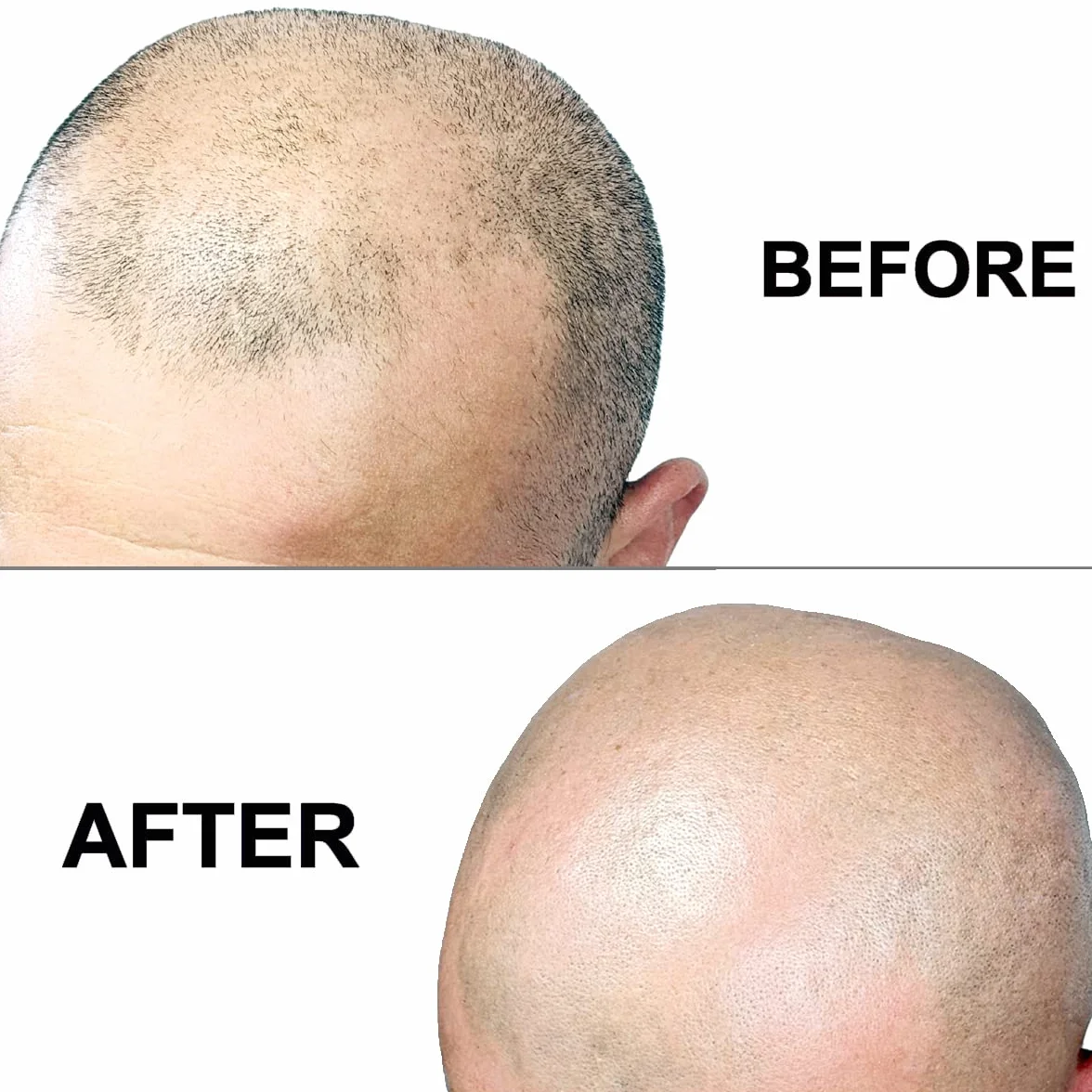 OmniShaver Maquinilla de afeitar para cabeza calva, cortador de pelo, auto limpia