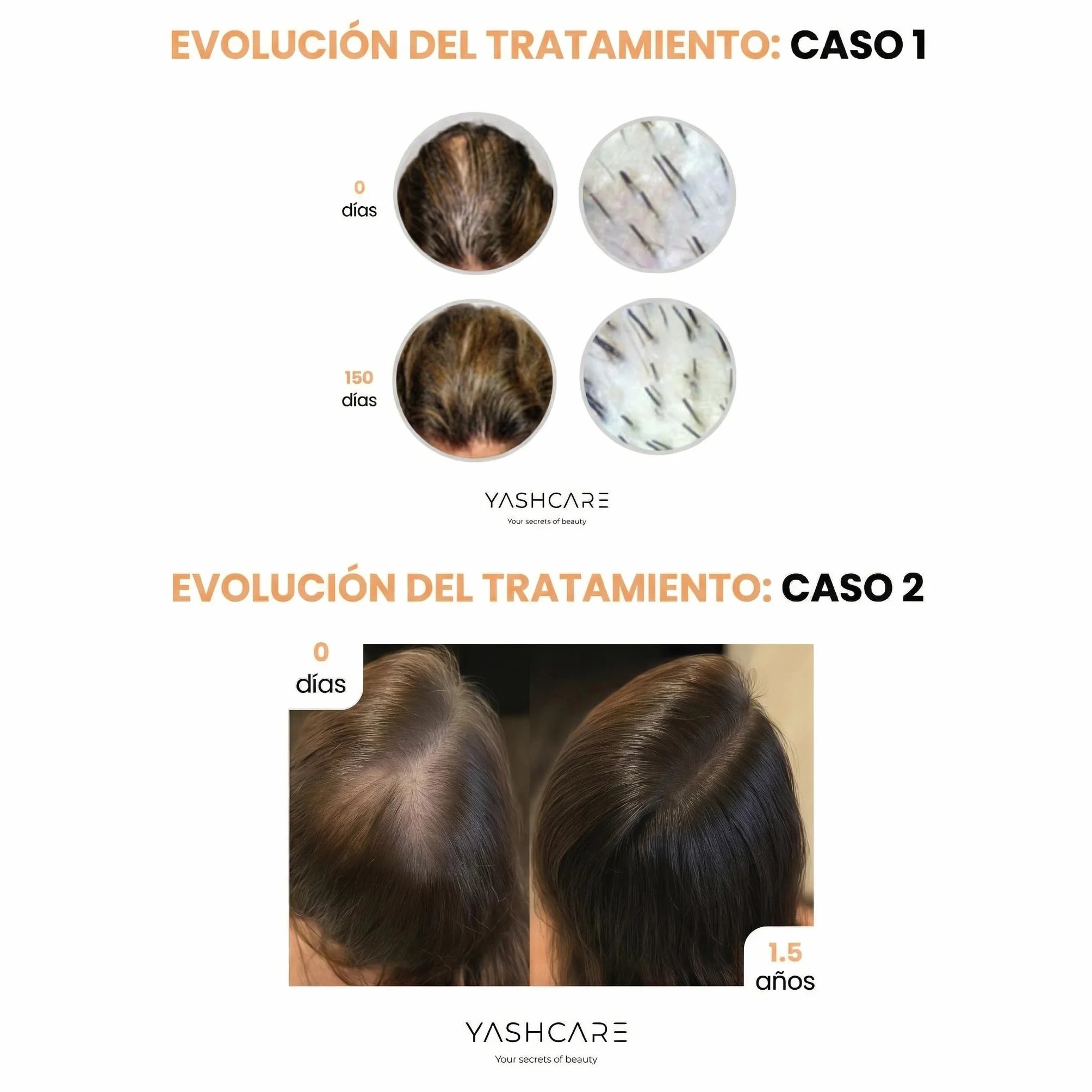 Serum Anticaida con Biotina para el Cabello 100 ml - Reduce Caída y Estimula Crecimiento