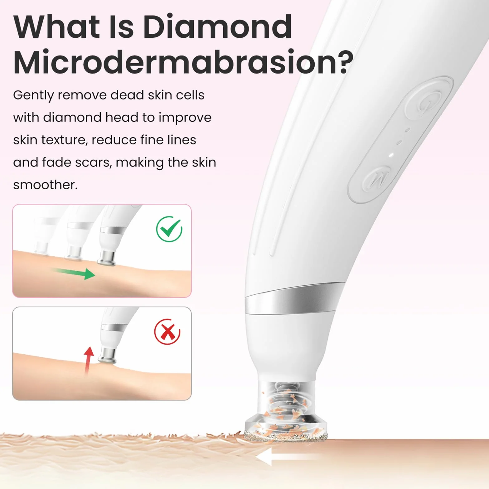 UNOISETION Máquina de microdermoabrasión de diamante, máquina facial portátil para exfoliación, removedor de puntos negros, aspiradora de poros para uso doméstico