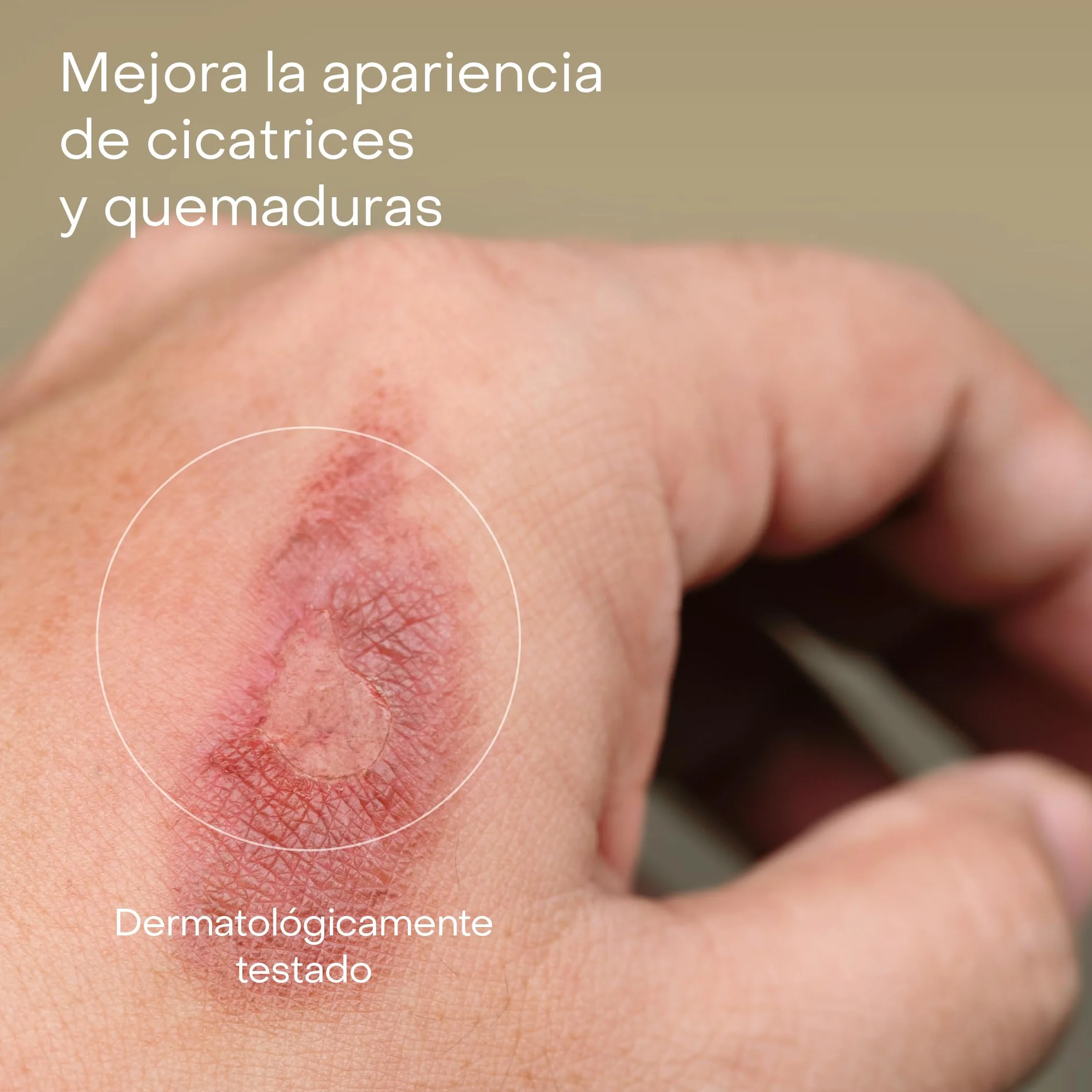 Repavar Aceite Rosa Mosqueta Puro 100% Primera Presión en Frío 15 ml