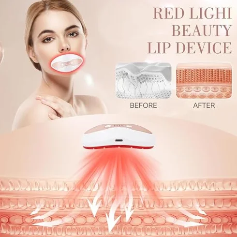 Dispositivo para labios recargable por USB, calentamiento 35-50°C, 4 niveles, suaviza arrugas