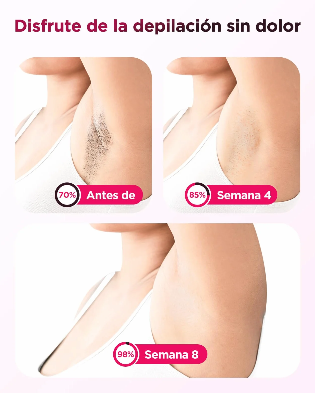 Depiladora Laser IPL con Refrigeración, 3 en 1, 9 Niveles, 999,900 Flashes, Luz Pulsada Indolora