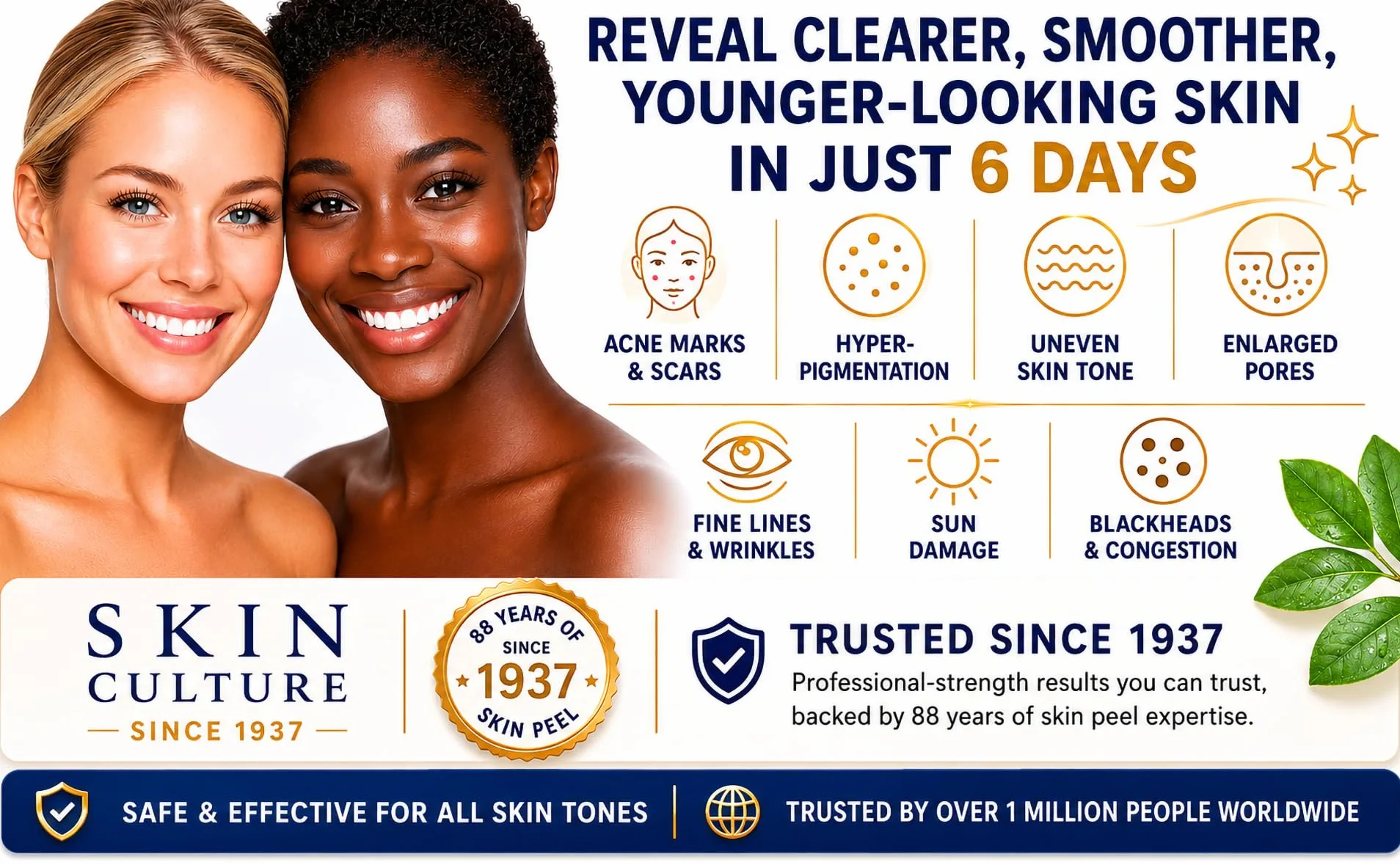 Skin Culture Juego de 5 tarros de tratamiento Skin Peel 4000 | Utilizado por miles de hombres y mujeres desde 1937 | Se deshace de cicatrices de acné, manchas, poros grandes, líneas finas, daños por