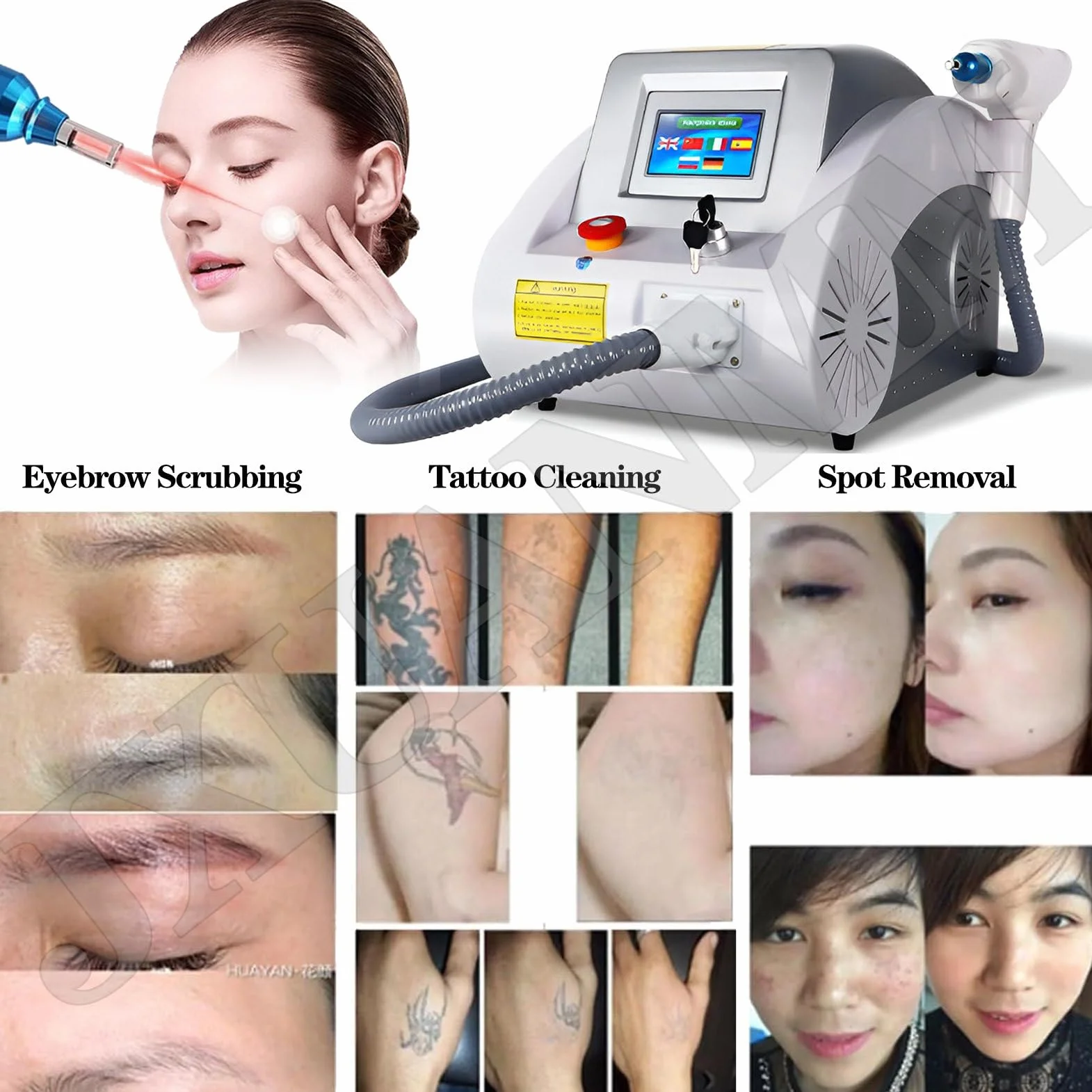 Máquina portátil de eliminación de Tatuajes con láser Pico Nd Yag con mira de Punto Rojo para rejuvenecimiento en Salones de Belleza. 6Probes
