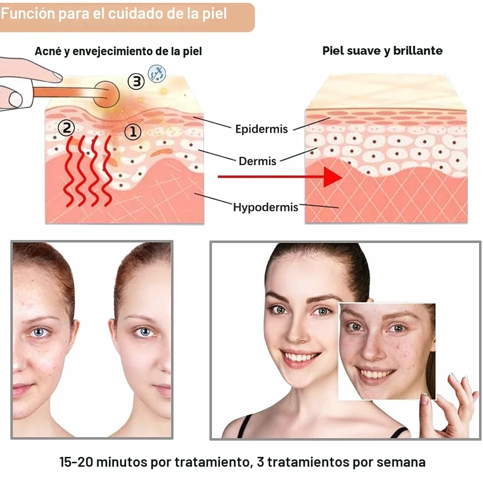 Alta Frecuencia Facial Aparato para Quitar Arrugas, Acné y Alopecia con 5 Electrodos