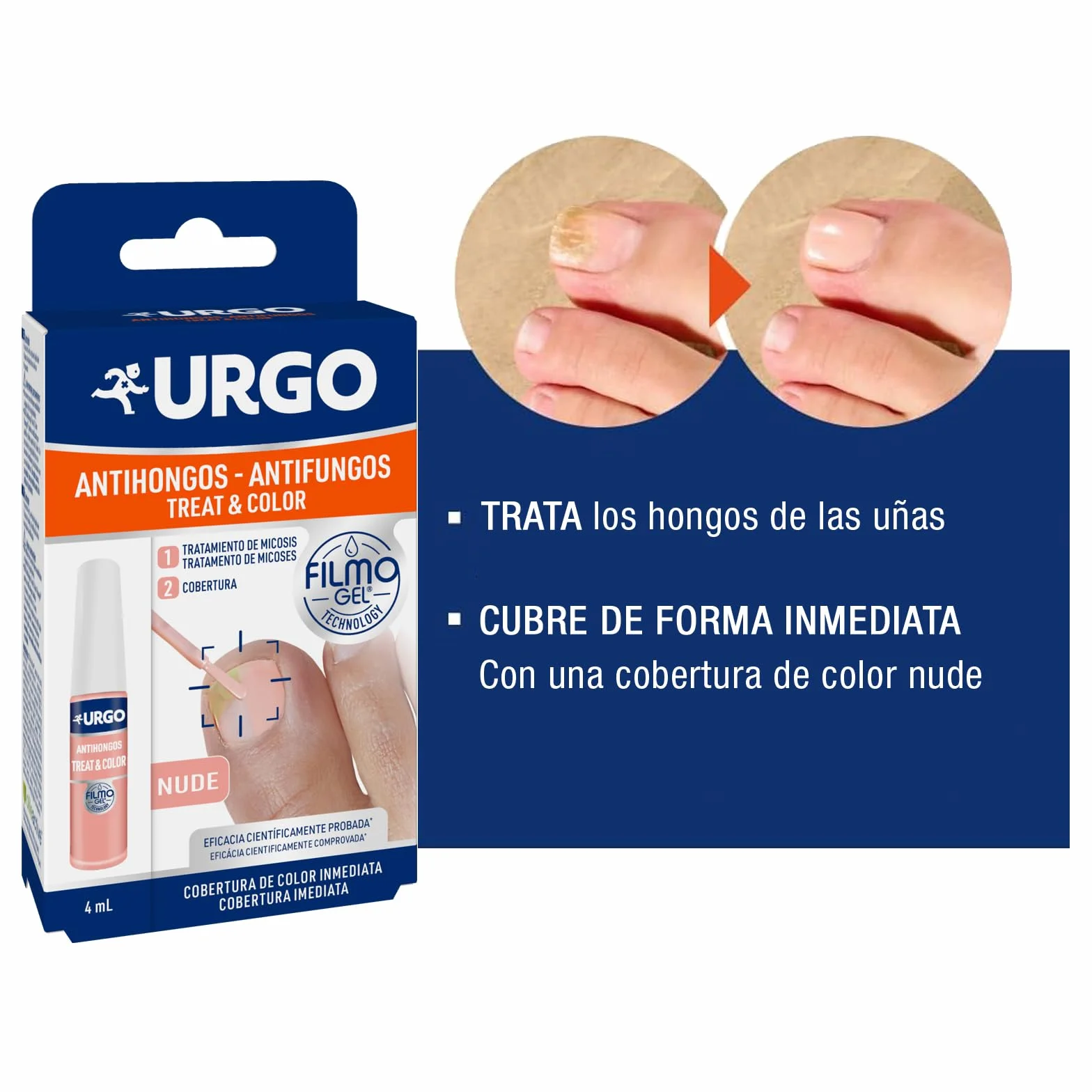 Urgo Treat & Color Filmogel Nude 4 ml Tratamiento Hongos Uñas Onicomicosis 2 en 1