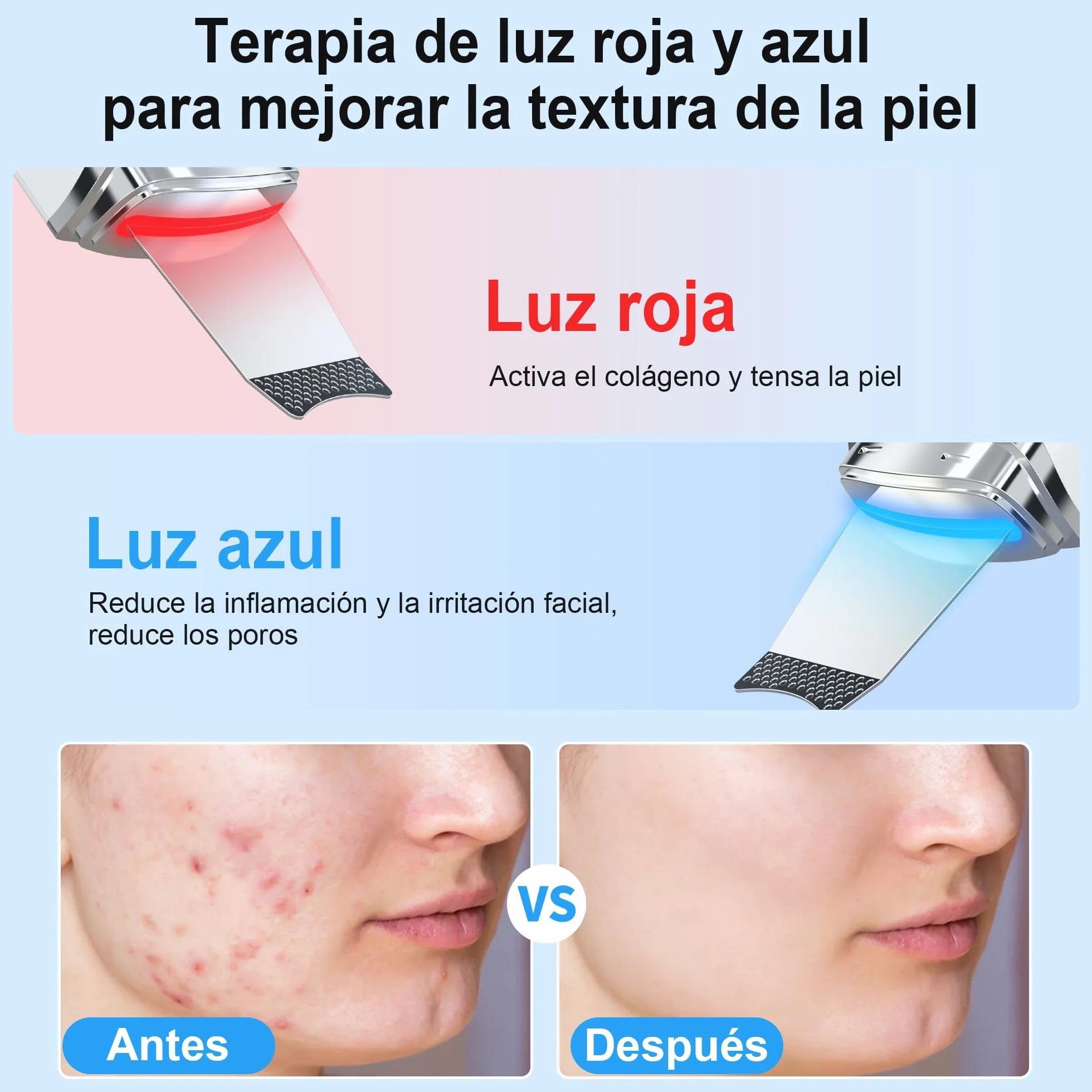Peeling Ultrasónico Facial, Limpiador Ultrasonidos con 4 Modos e Intensidad Ajustable, Luz Roja y Azul, Skin Scrubber