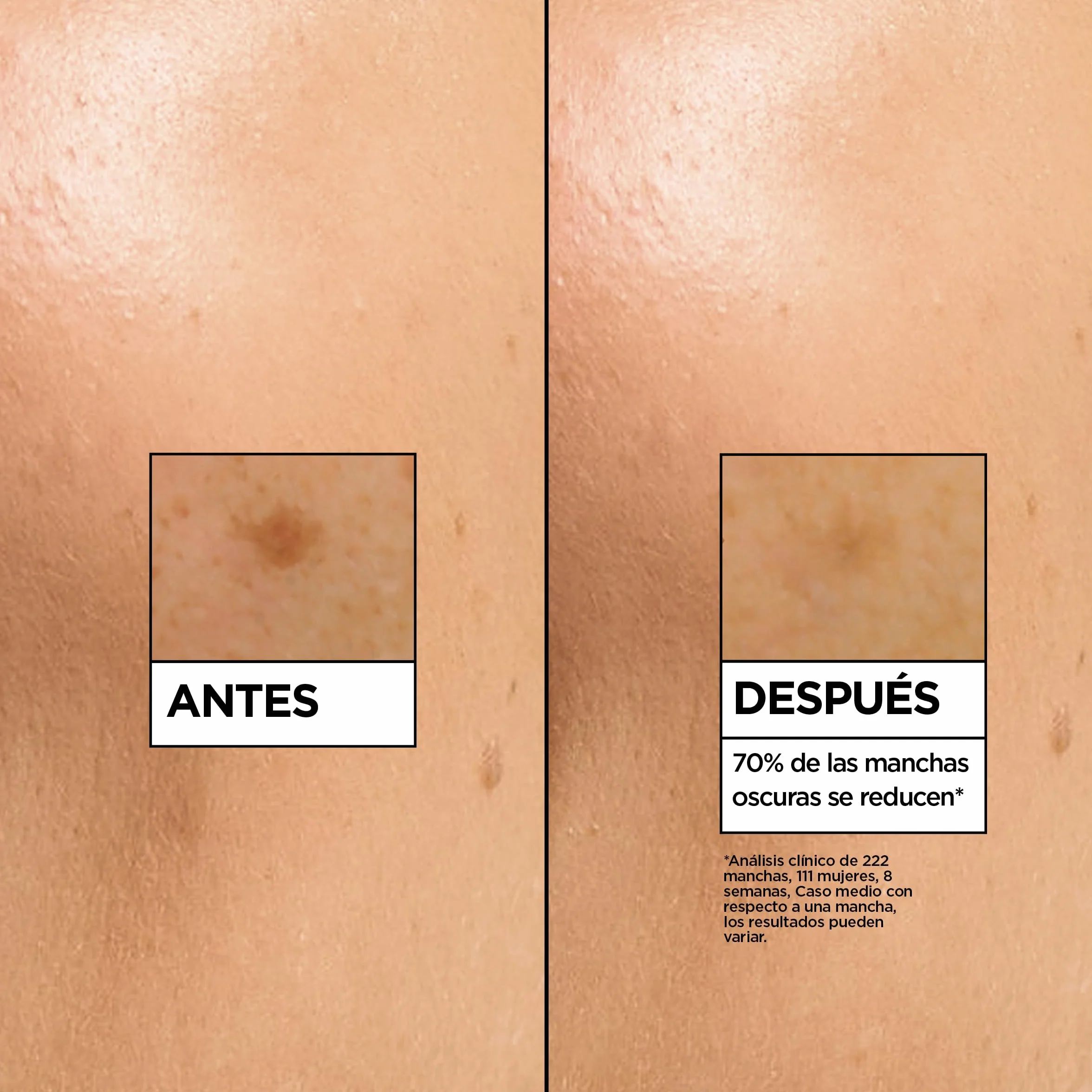 Garnier SkinActive Sérum Antimanchas Vitamina C 4% Niacinamida Ácido Salicílico Melasyl 30 ml