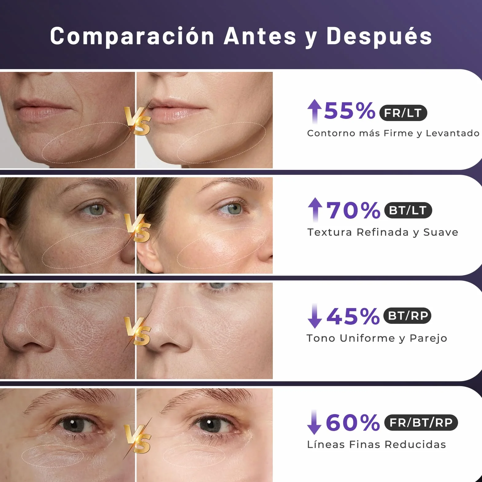 Aparato Radiofrecuencia Facial 5 en 1 Masajeador Facial de Microcorriente Antiarrugas Reafirmante Lifting Rostro y Cuello