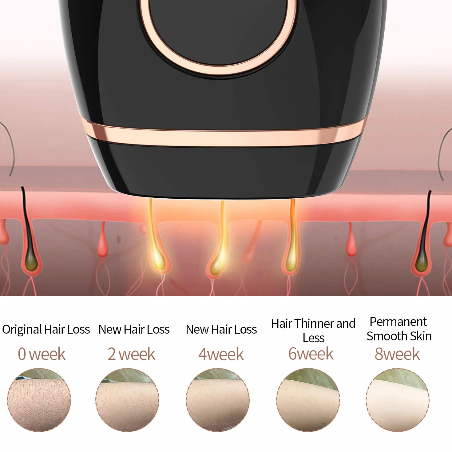 Depiladora Luz pulsada IPL, Dispositivo de depilación permanente sin dolor 999,999 flashes faciales de cuerpo entero en el hogar para mujeres hombres