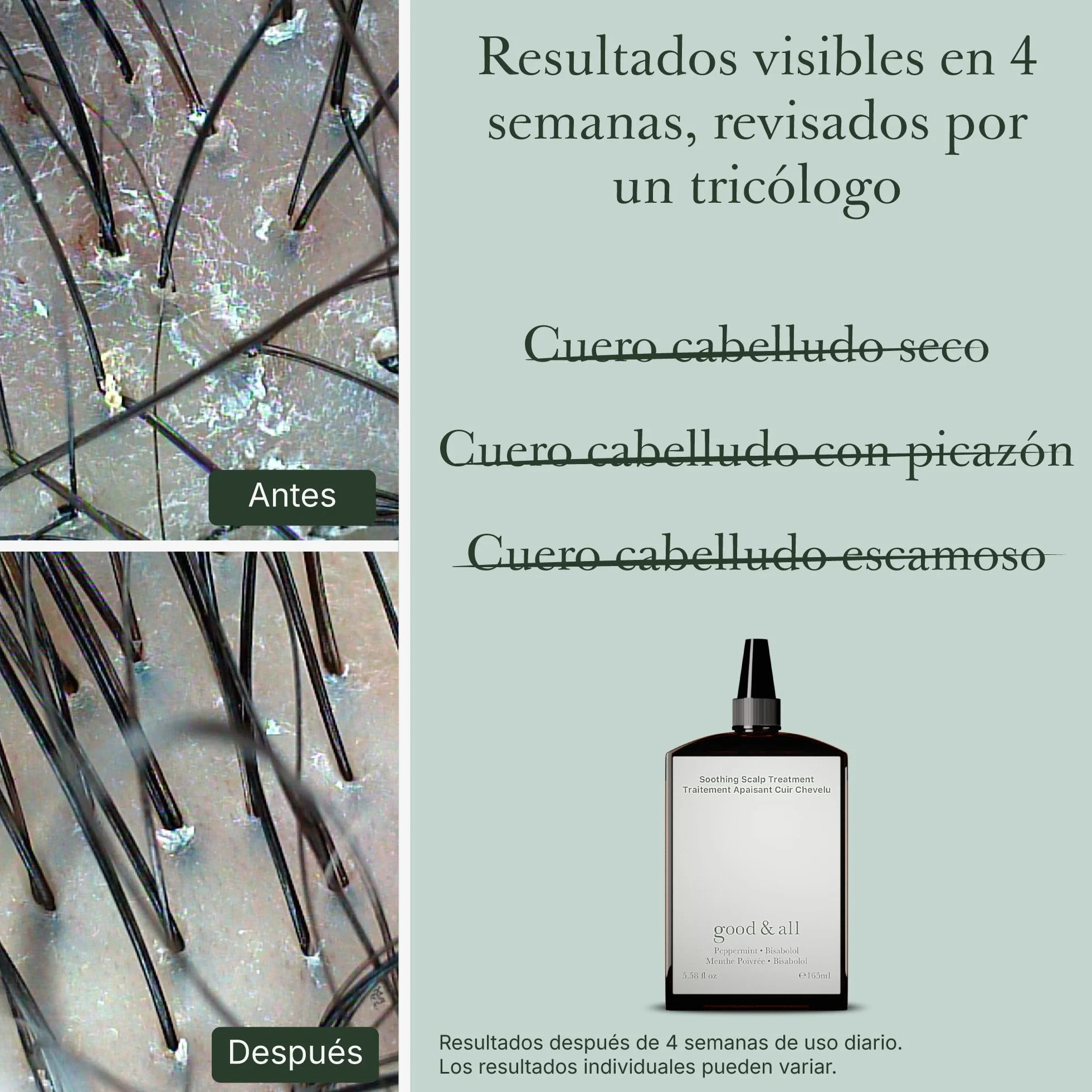 Good&All Tratamiento para el Cuero Cabelludo Seco y Sensible - Alivia el Picor con Menta y Bisabolol - 165ml