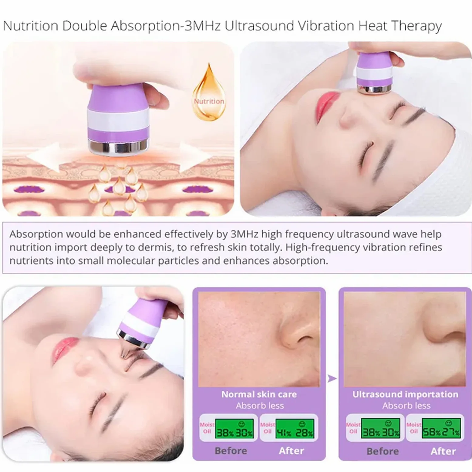 Máquina facial galvánica profesional 5 en 1: dispositivo de belleza de microdermoabrasión e iontoforesis para limpieza profunda, infusión de suero y estiramiento de la piel, sistema de spa facial en