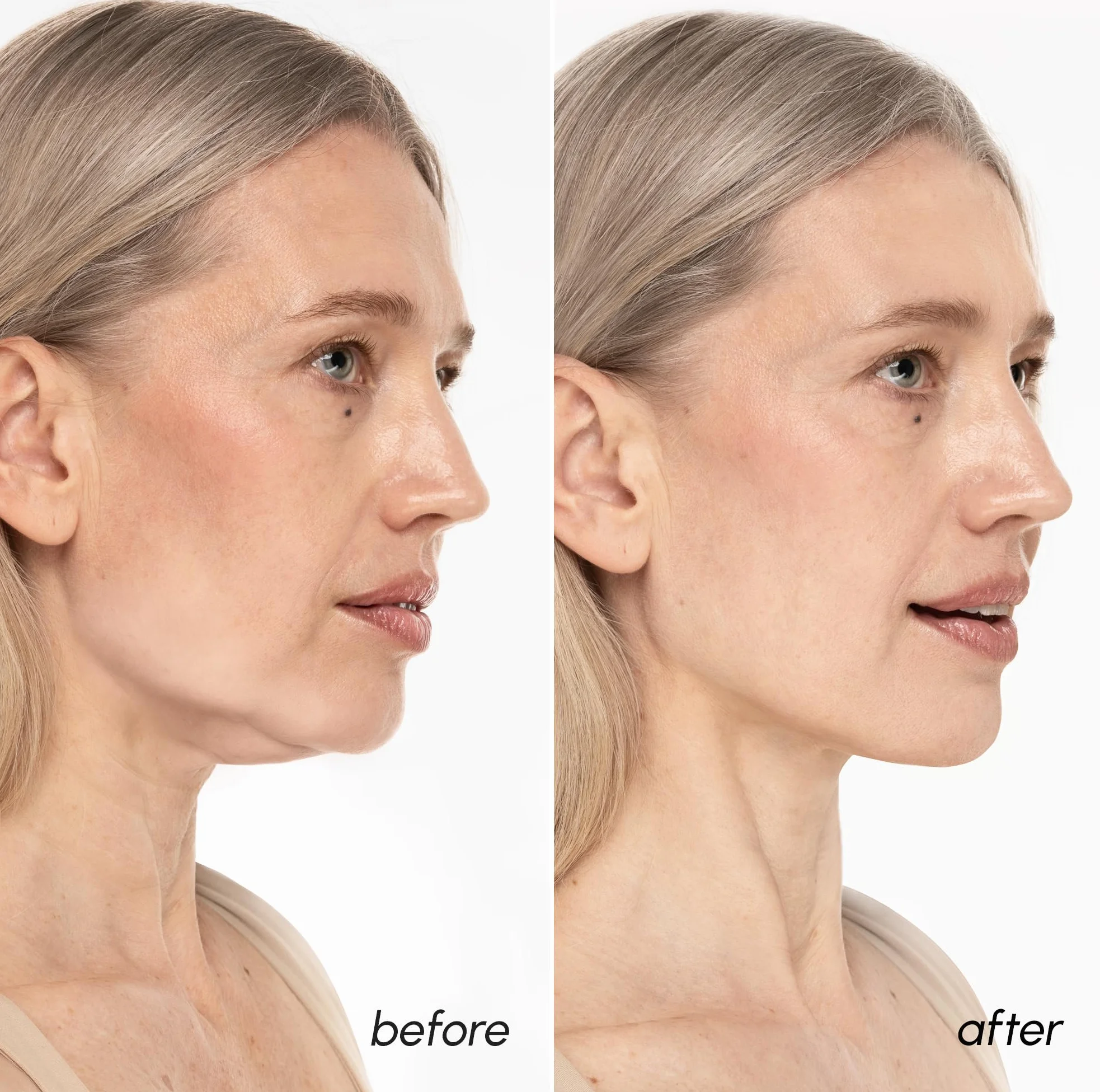 Máscara de elevación facial con oro 24K, colágeno, retinol y ácido hialurónico para mujer