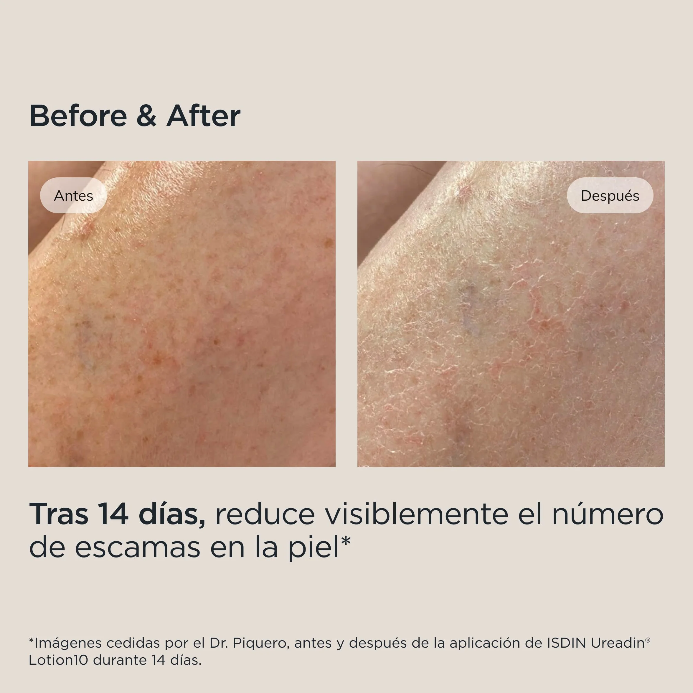 ISDIN Ureadin Lotion10 10% Urea Loción Hidratante Para Piel Seca 400 ml