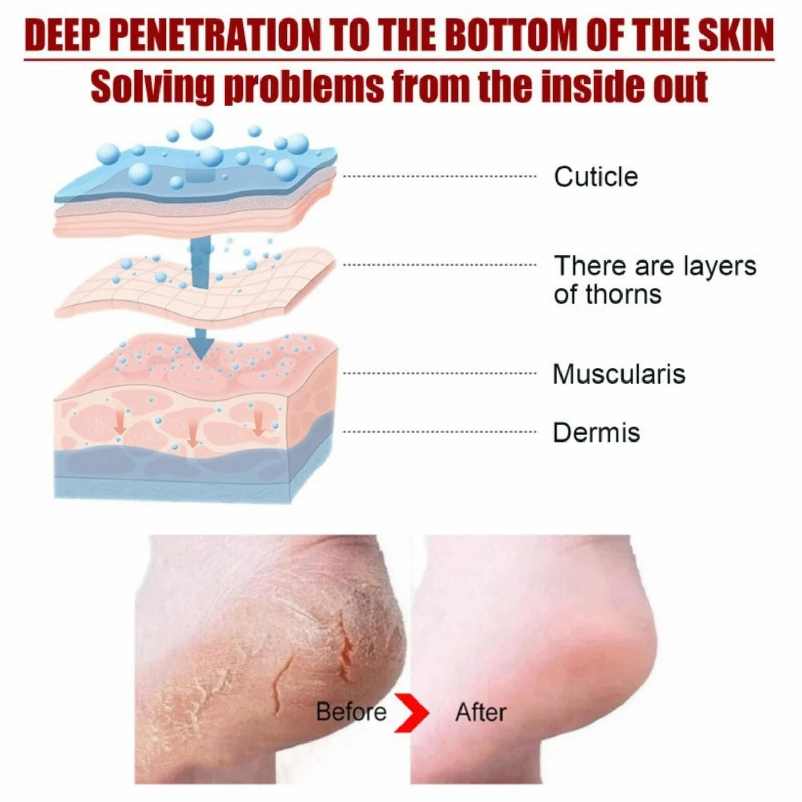 Máscara de pie para peeling de melocotón, máscara de pies hidratante con nueces de coco- Cuidado de callos y pieles muertas - Pie Hidratante, exfoliante, callo peeling pies