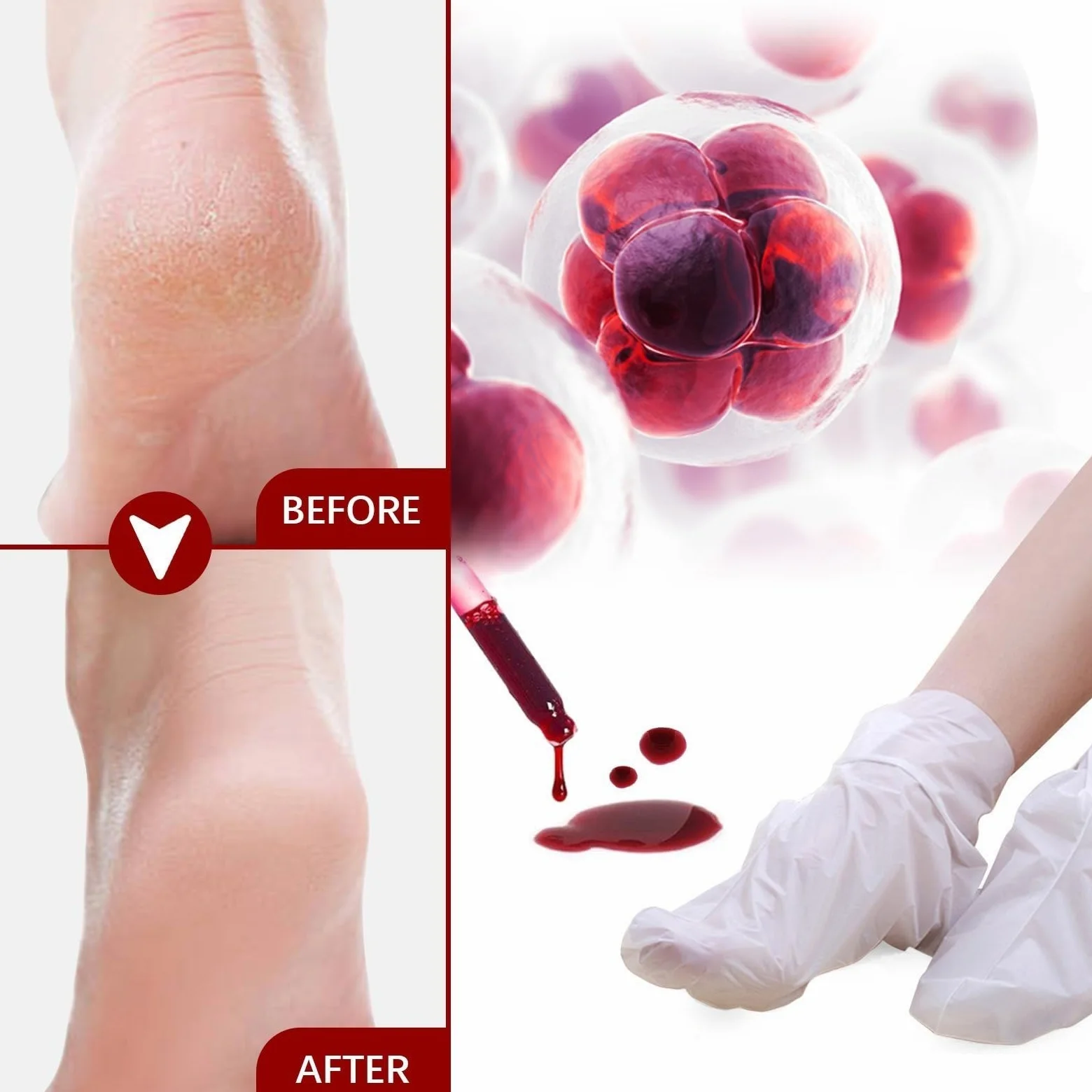 Máscara de pie para peeling de melocotón, máscara de pies hidratante con nueces de coco- Cuidado de callos y pieles muertas - Pie Hidratante, exfoliante, callo peeling pies