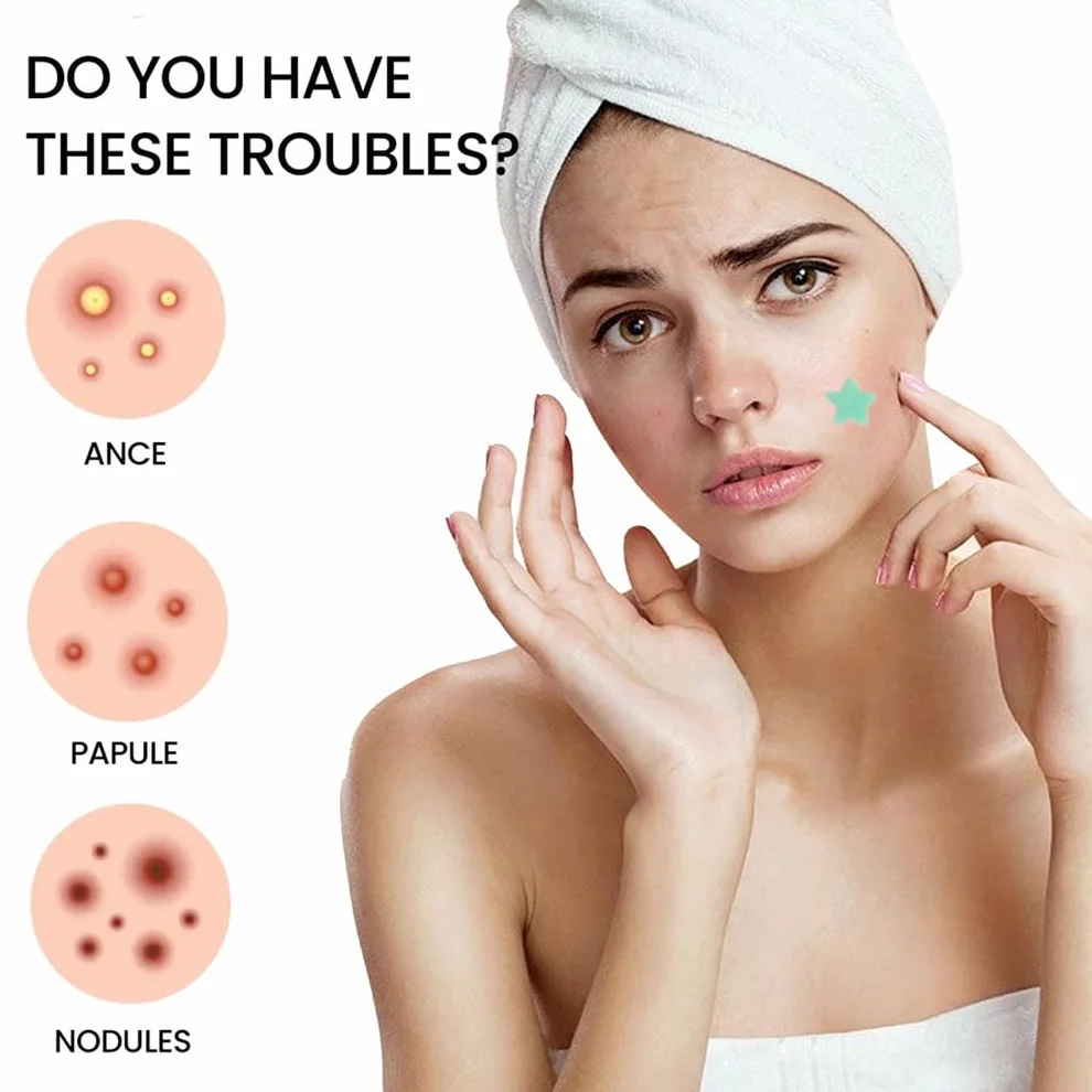 Star Pimple Patches, Hydrocolloid Spot Patches with Tea Tree Oil, 2 Sizes, 5 Colors, 200 Dots, Face Body Blemish Cover (1 Box)