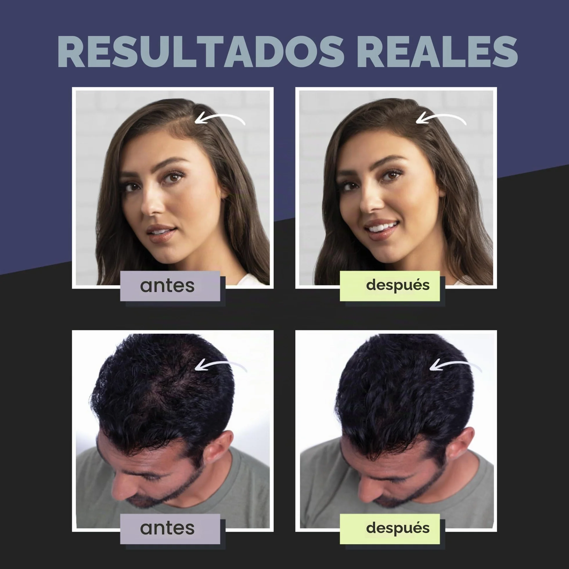 Toppik Fibras Capilares Castaño Oscuro, Fibras de Queratina para Densidad, 27,5 g