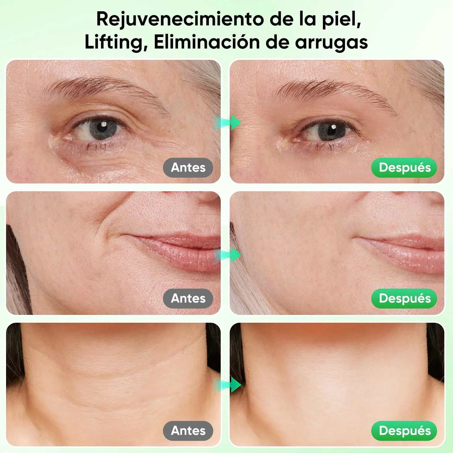 Masajeador Facial Electrico 6 Modos 7 Colores Led 45℃ EMS Antiarrugas Reafirmante Lifting