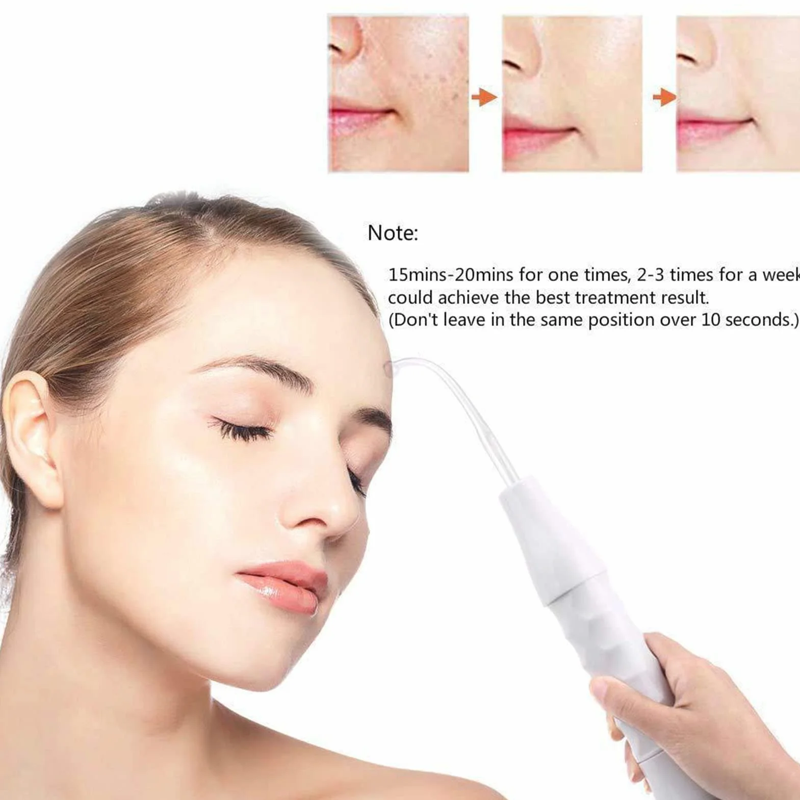 Fyearfly Máquina facial portátil de alta frecuencia con 4 tubos de peine, eliminador de ácaros, tratamiento del acné, cuidado facial, negro, metal, cristal