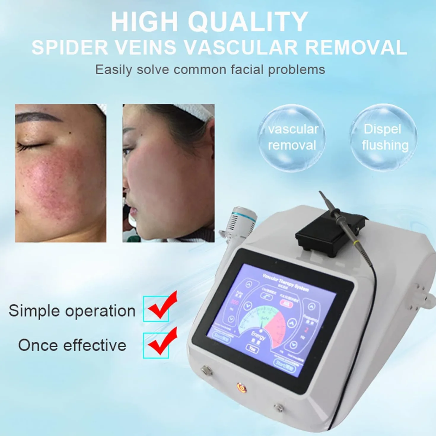 Dispositivo de eliminación de arañas vasculares de Alta frecuencia, máquina de Belleza para Eliminar Venas de Hilo Facial, Manchas de Vasos sanguíneos Rojos, para piernas, Cara, Nariz, para Mujeres