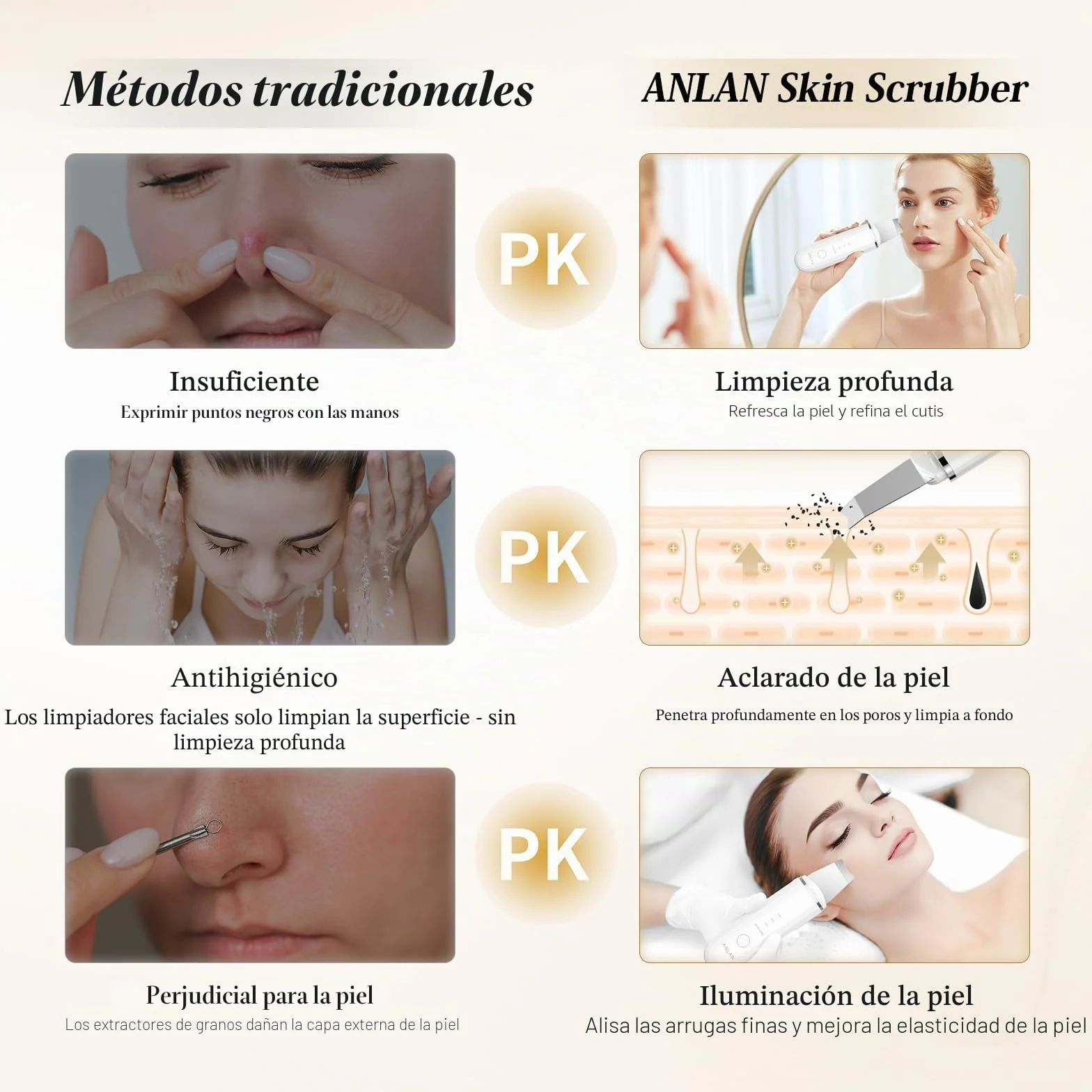 ANLAN Peeling Ultrasónico Facial Skin Scrubber Exfoliación Limpiador de Poros (Blanco)